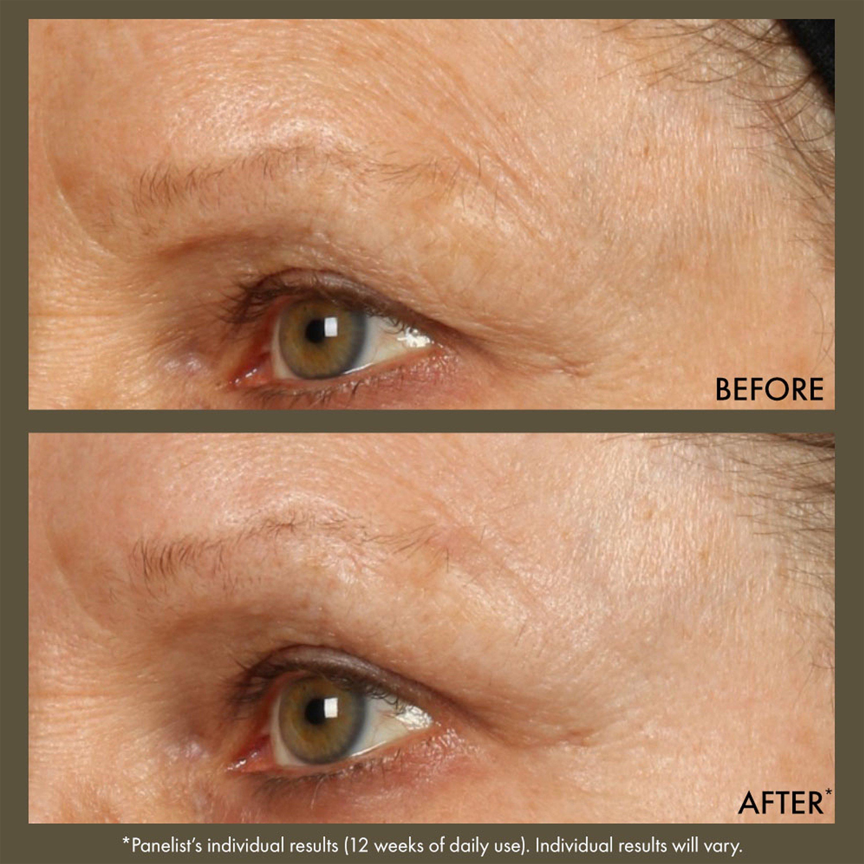 Clear - Origins - PLANTSCRIPTION™ Active Wrinkle Correction Serum - 5