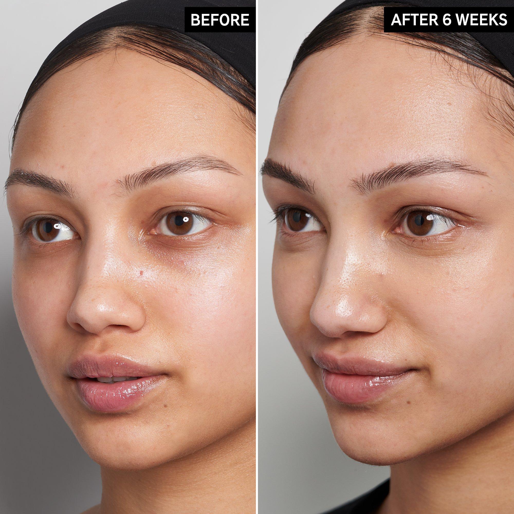 Clear - The Inkey List - Vitamin C and EGF Face Serum - 4
