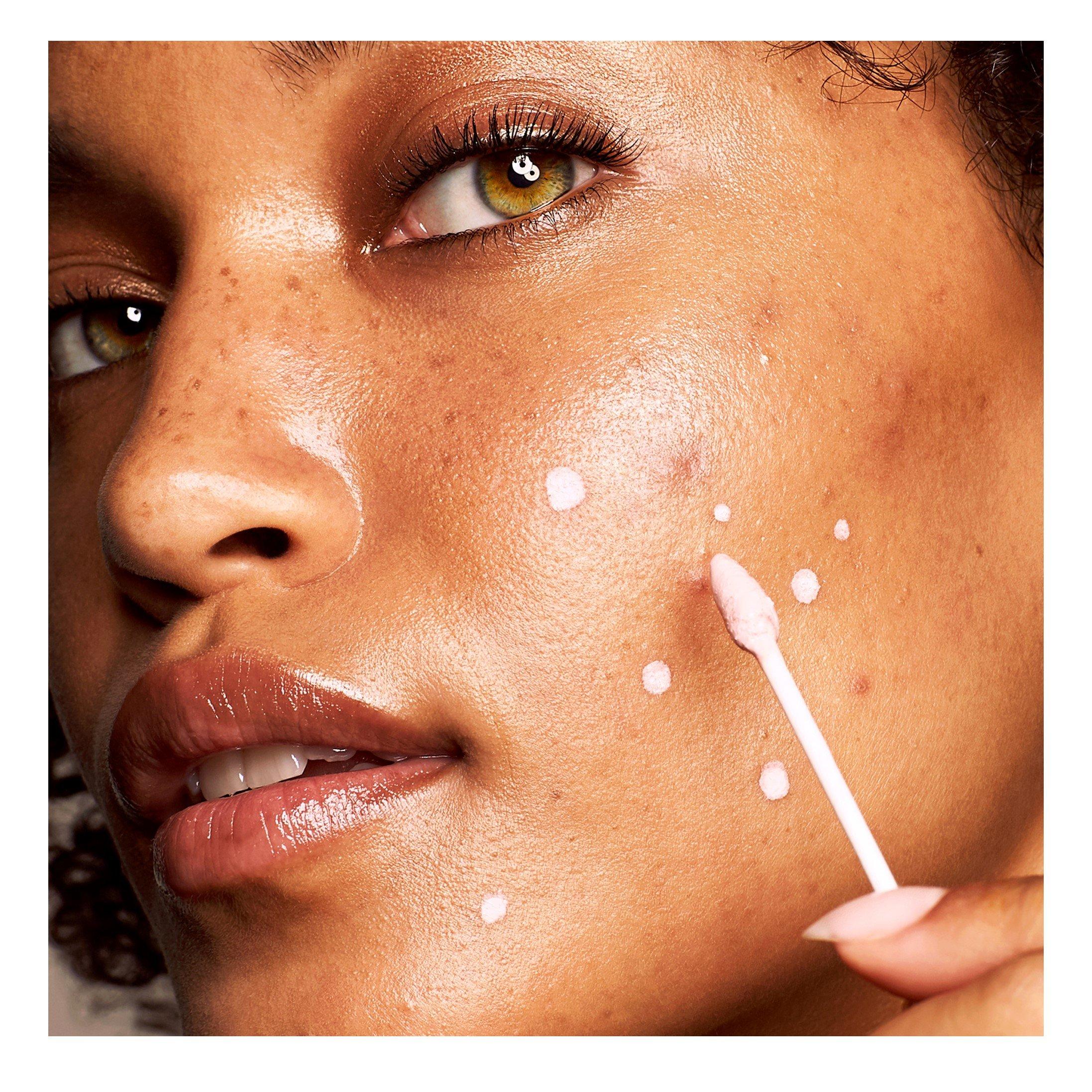 None - Kate Somerville - EradiKate® Blemish Treatment - 4