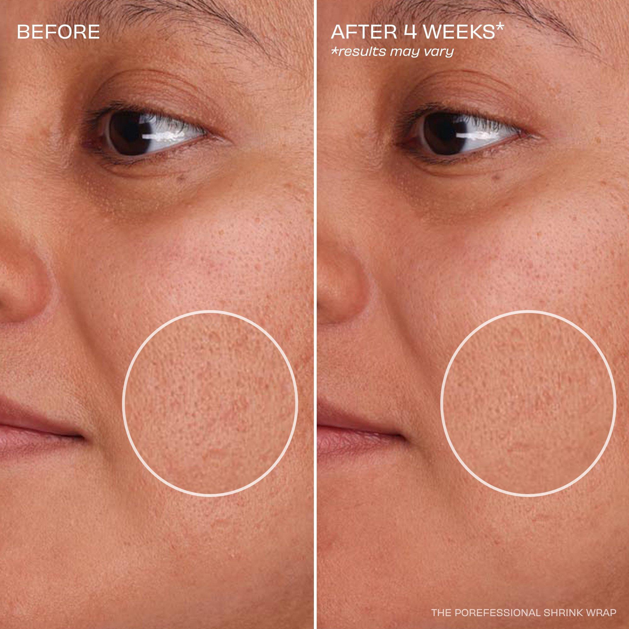 Clear - Benefit - The POREfessional Shrink Wrap Overnight AHA+PHA Pore Treatment - 6