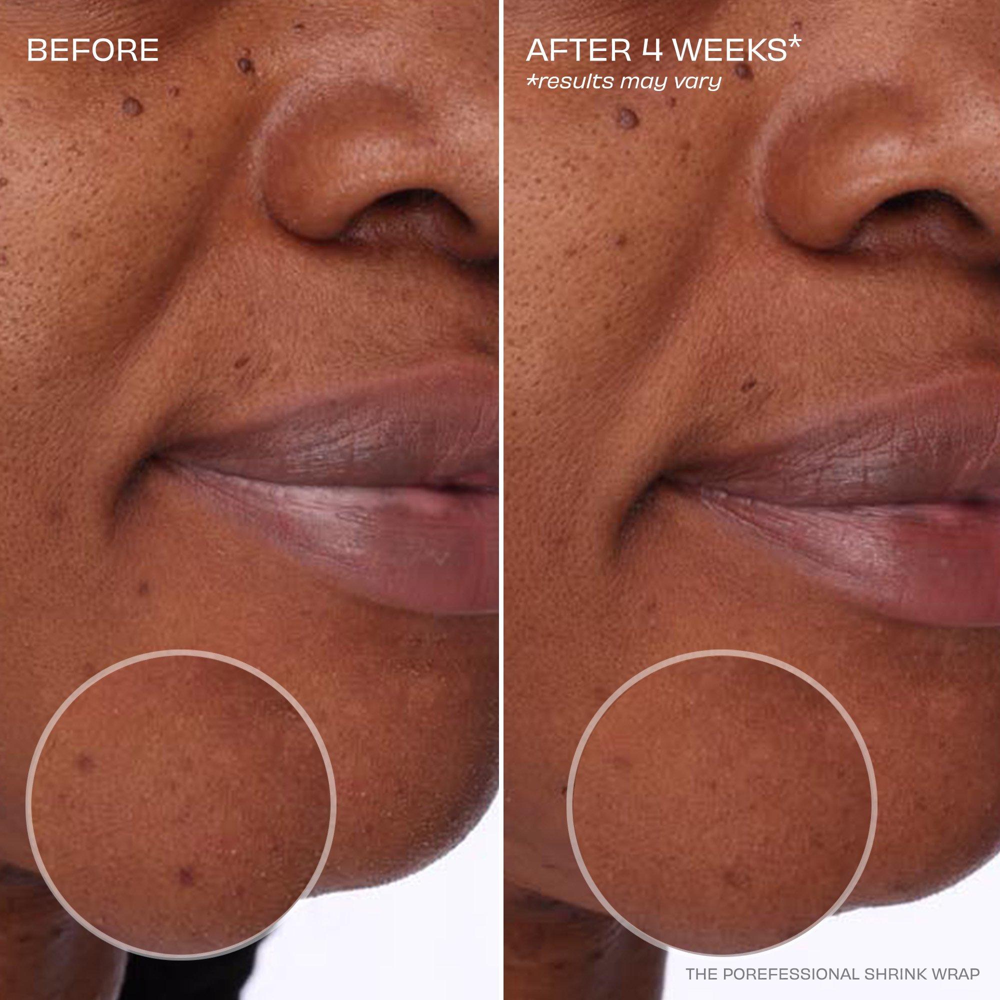 Clear - Benefit - The POREfessional Shrink Wrap Overnight AHA+PHA Pore Treatment - 7