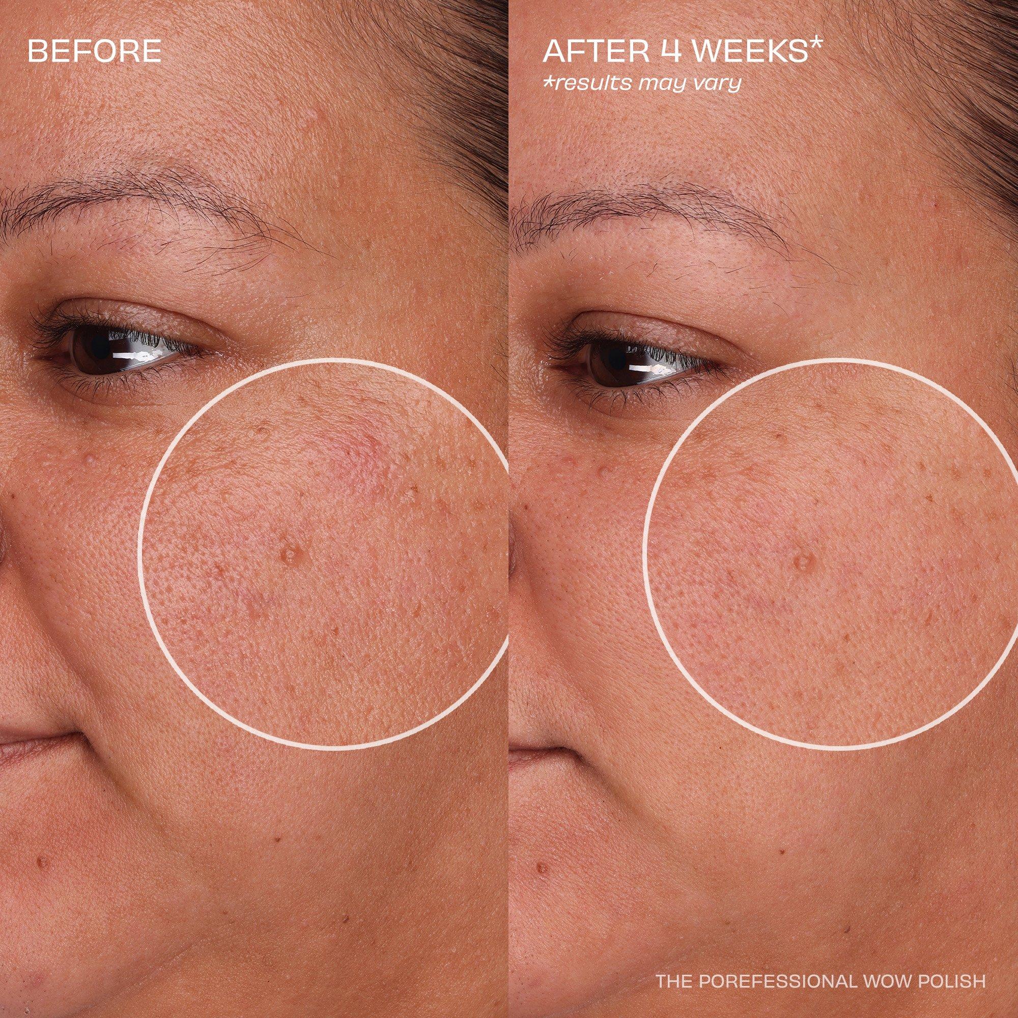 Clear - Benefit - The POREfessional Wow Polish Triple Pore-Exfoliating Powder - 5