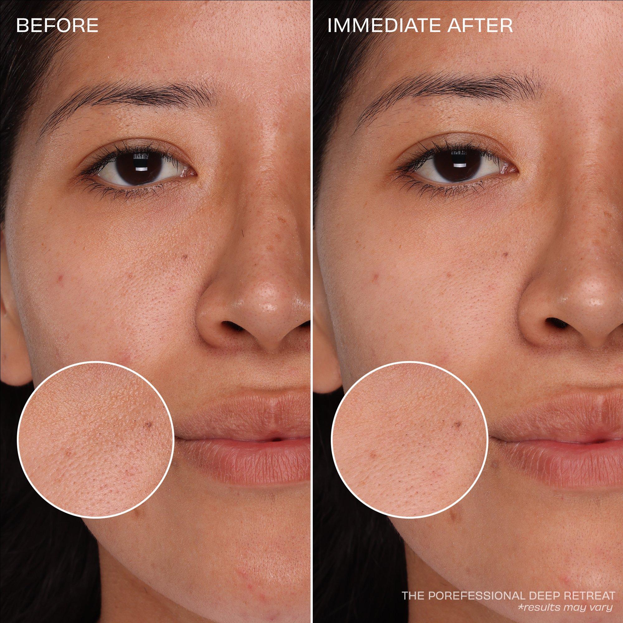 Clear - Benefit - The Porefessional Deep Retreat Mask - 8