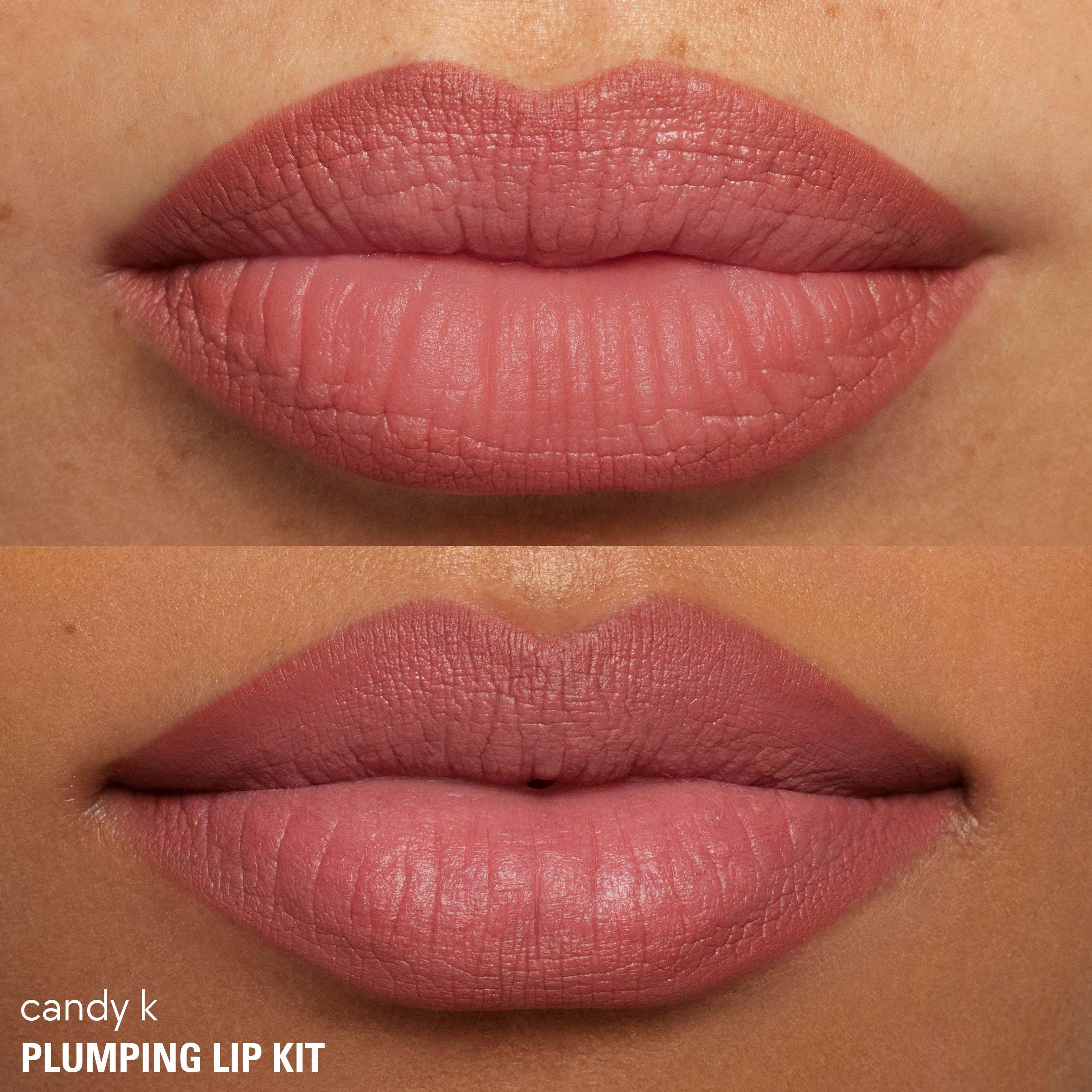 Candy K - Kylie Cosmetics - Kylie Cosmetics Plumping Lip Kit - 4