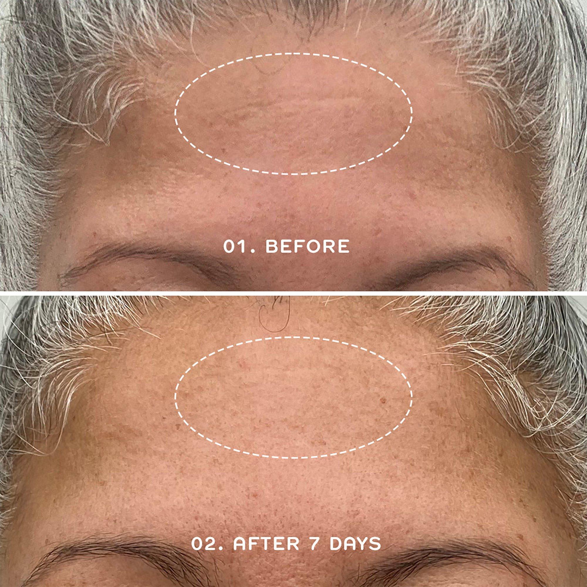 None - Ren - Clean Skincare Bio Retinoid Youth Serum - 6