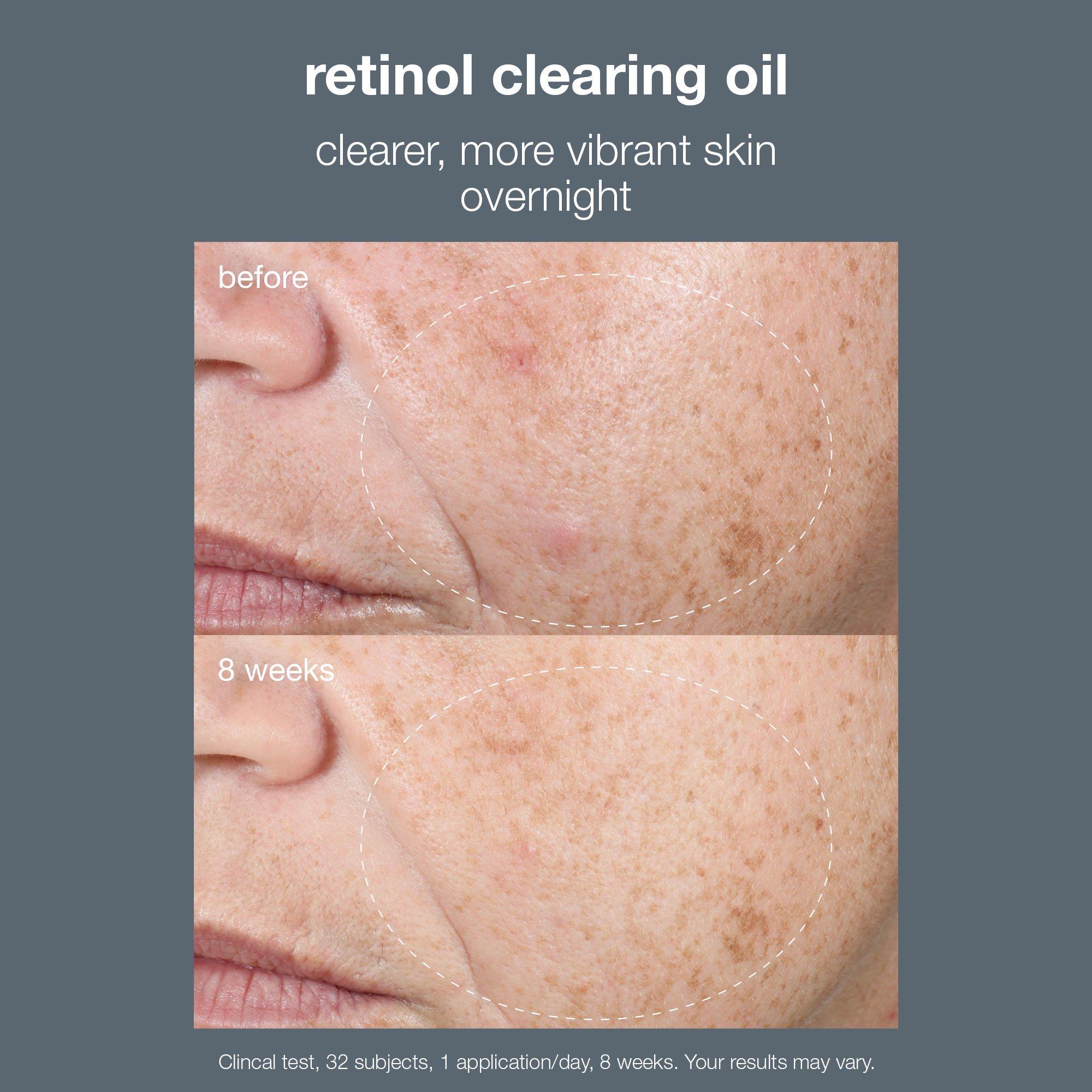 Clear - Dermalogica - Retinol Clearing Oil 30ml - 6