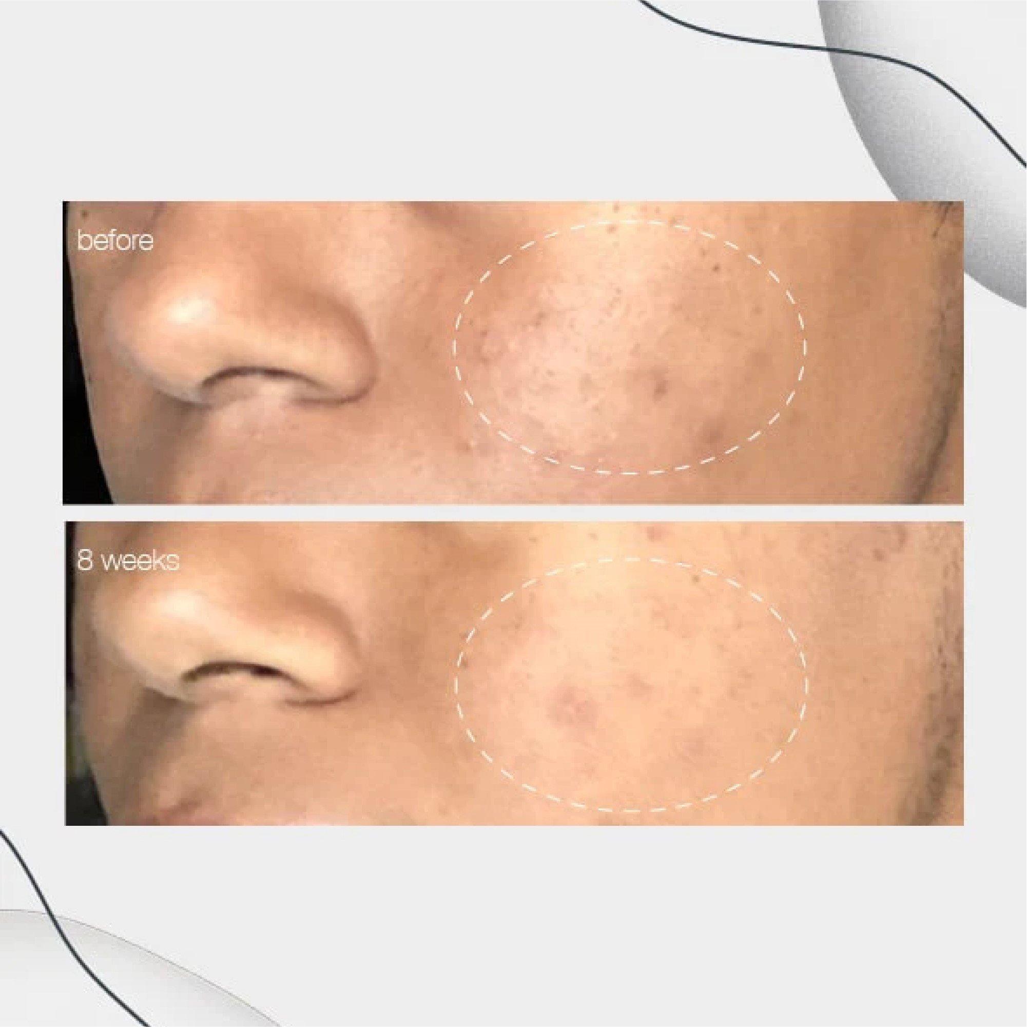 Clear - Dermalogica - Powerbright Dark Spot Serum 30ml - 2