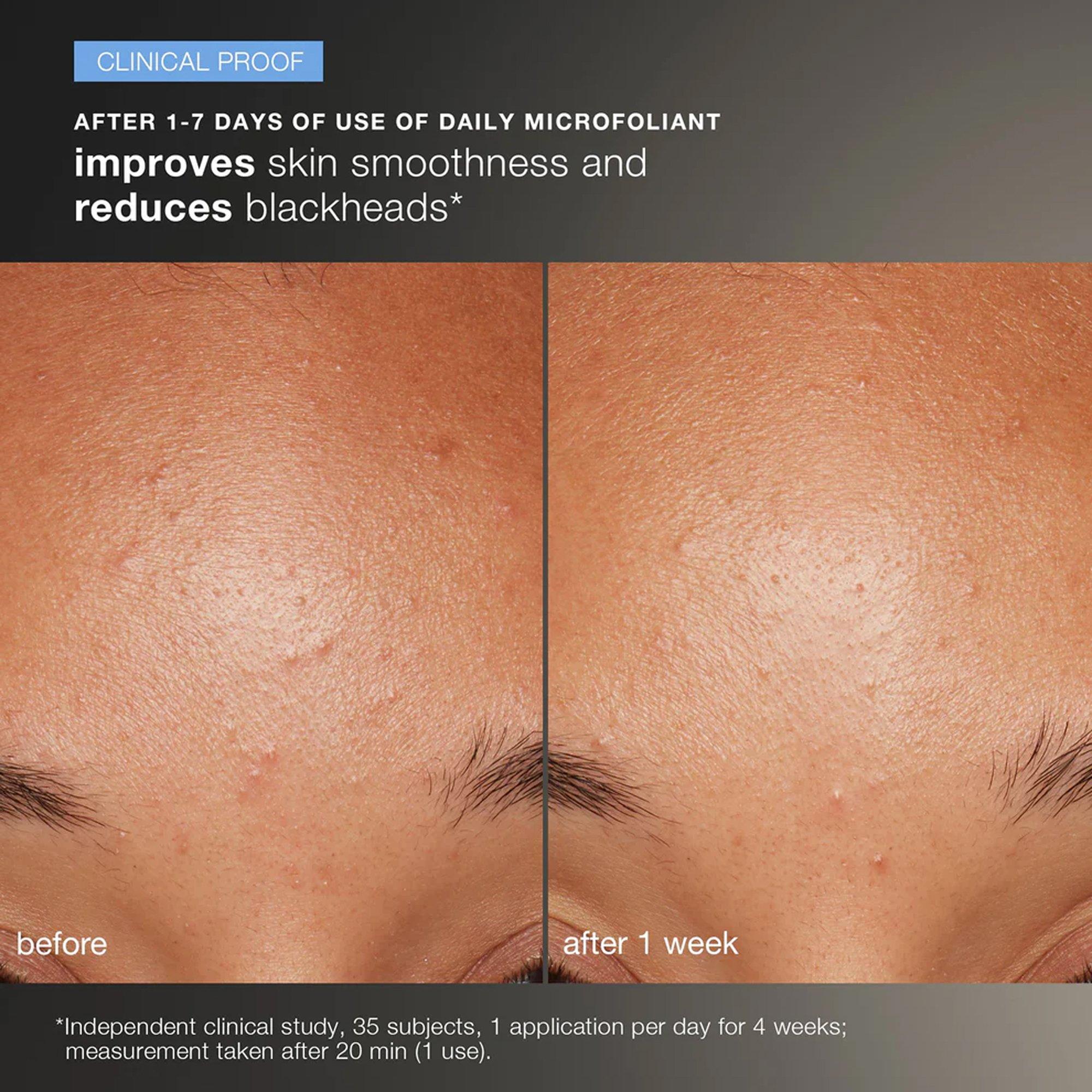 Clear - Dermalogica - Discover Healthy Skin - 4