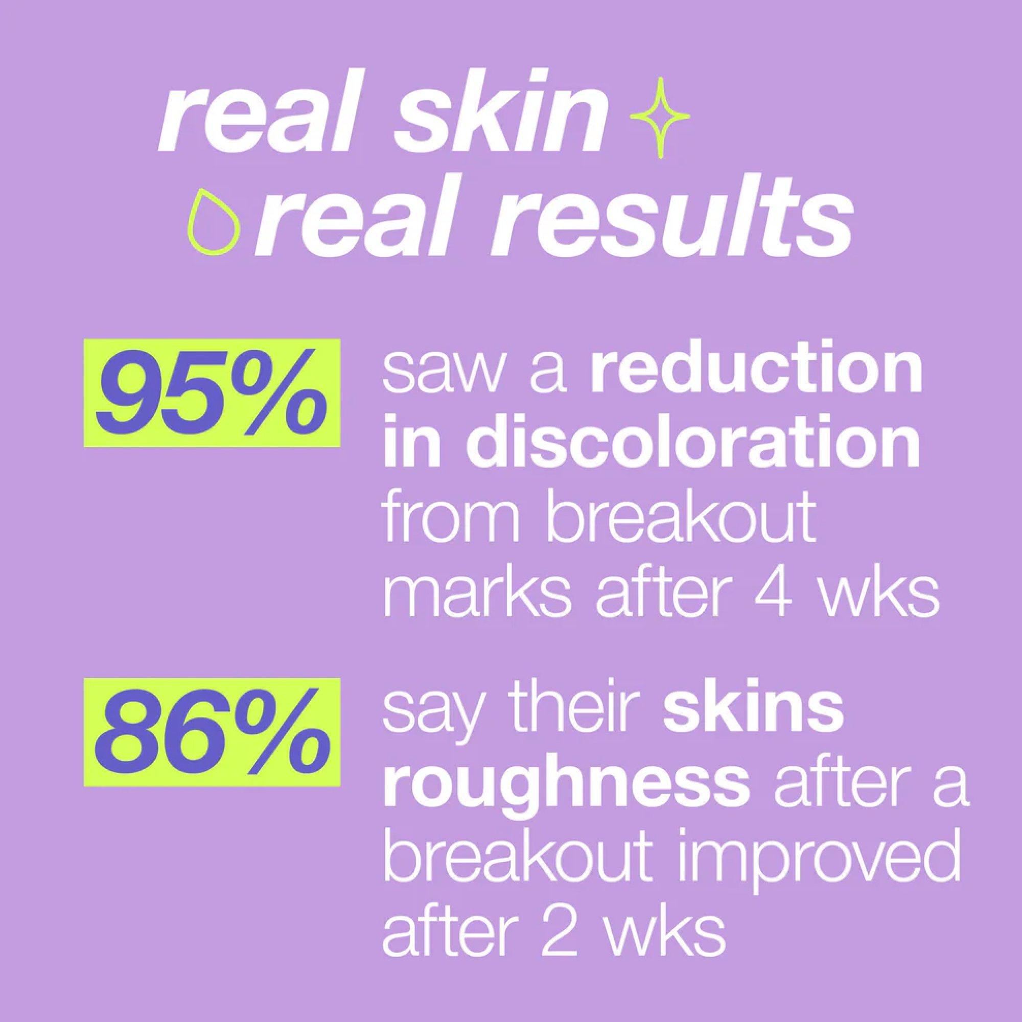 Clear - Dermalogica - post-breakout fix 15ml - 7