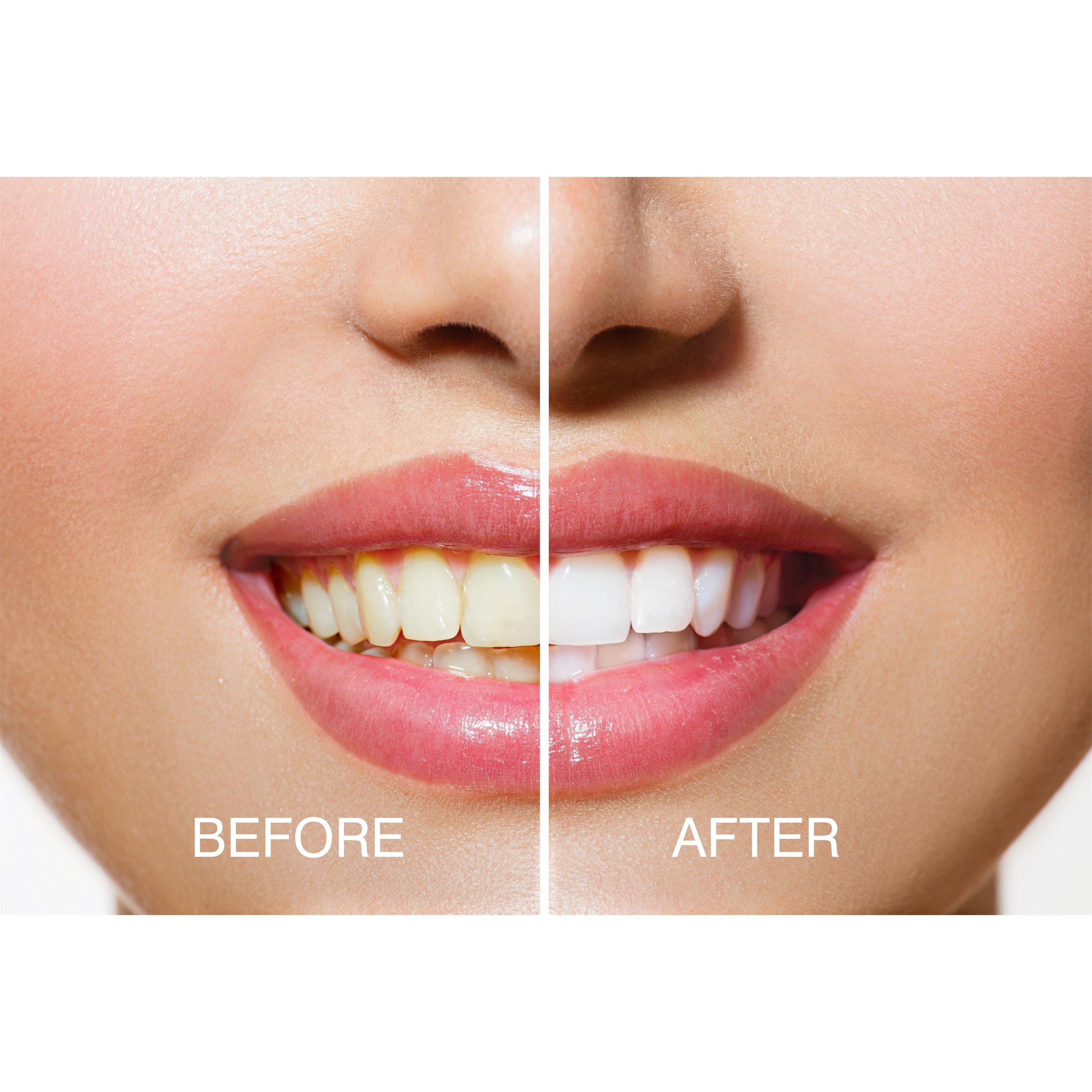 White - Rio - Rio Smile White Advanced Blue-Light Teeth Whitenin - 4