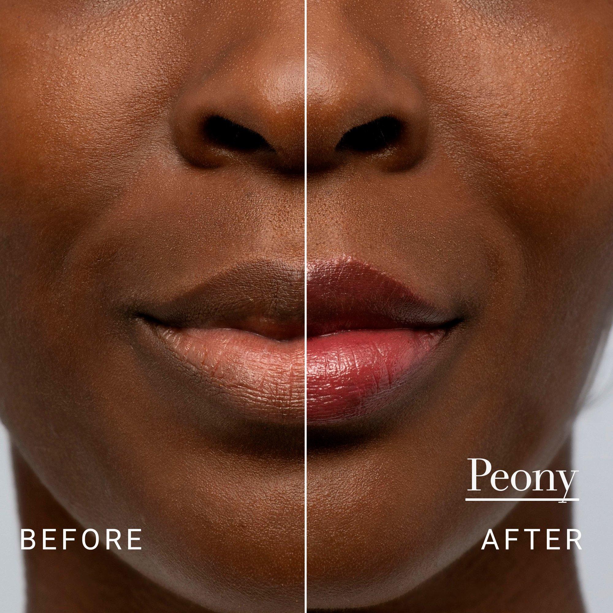 Clear - FRESH - Fresh Sugar Lip Treatment - 8