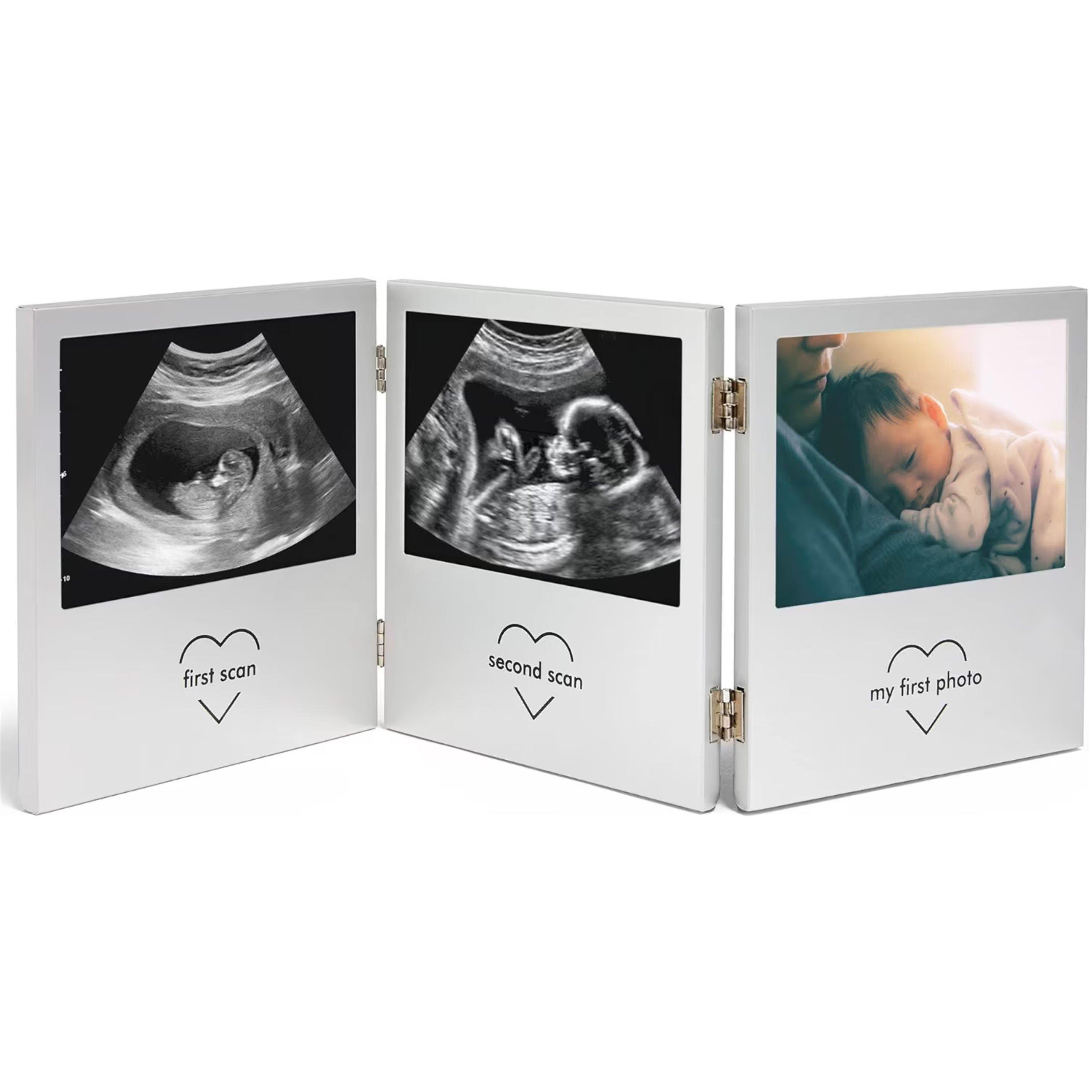 VonHaus Vonhaus - Baby Scan Photo Frame, Multi-Photo