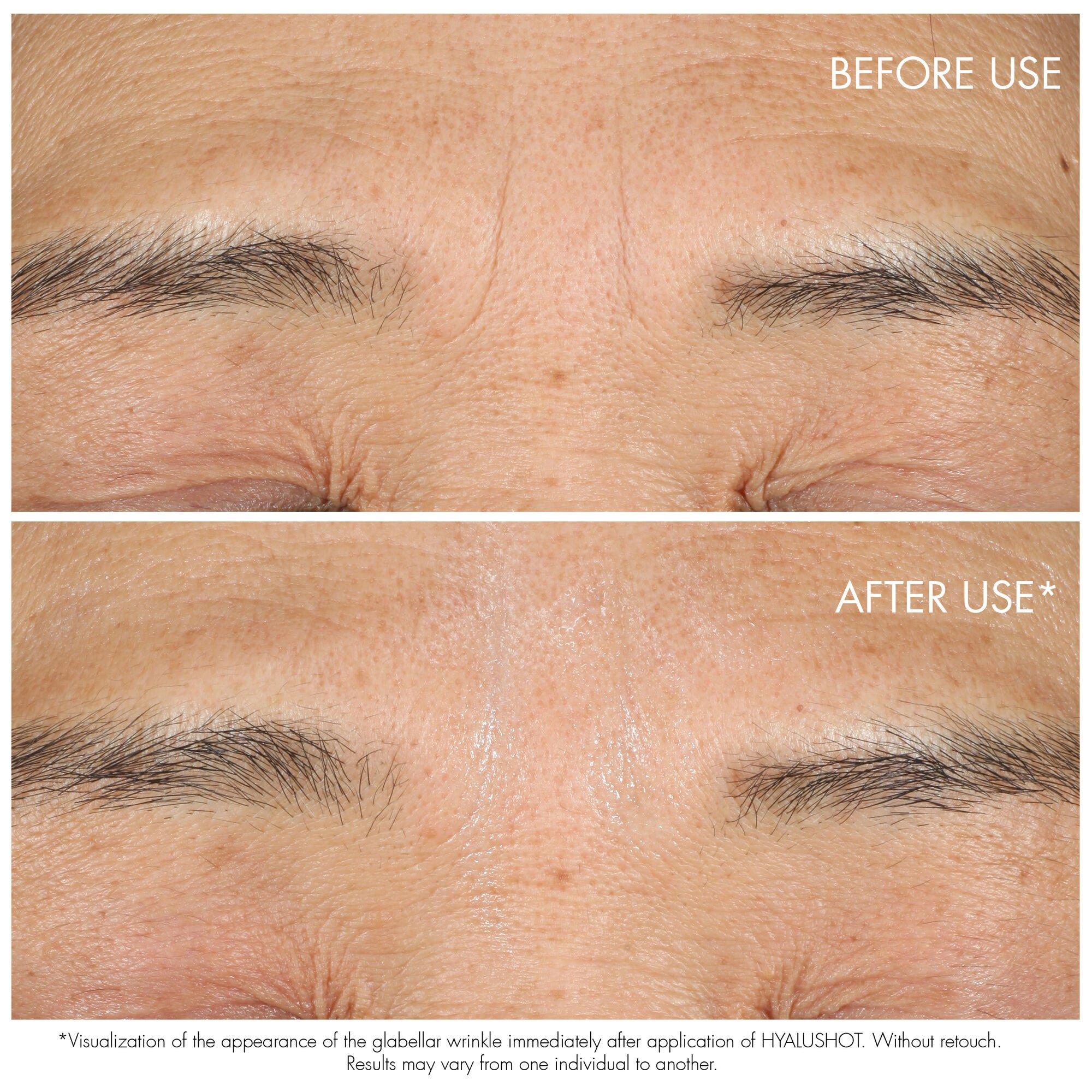 None - DIOR - Capture Totale Hyalushot - 3