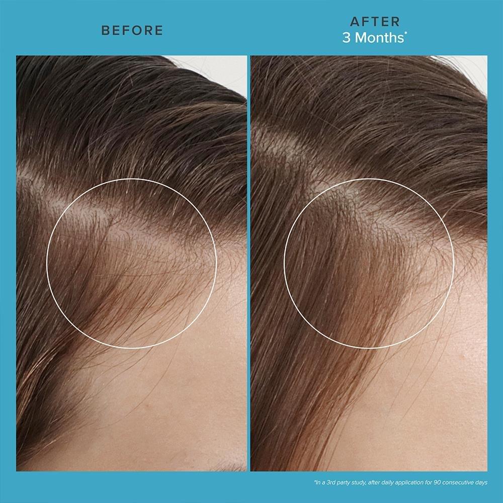 None - Living Proof - Scalp Care Revitalizing Treatment - 2