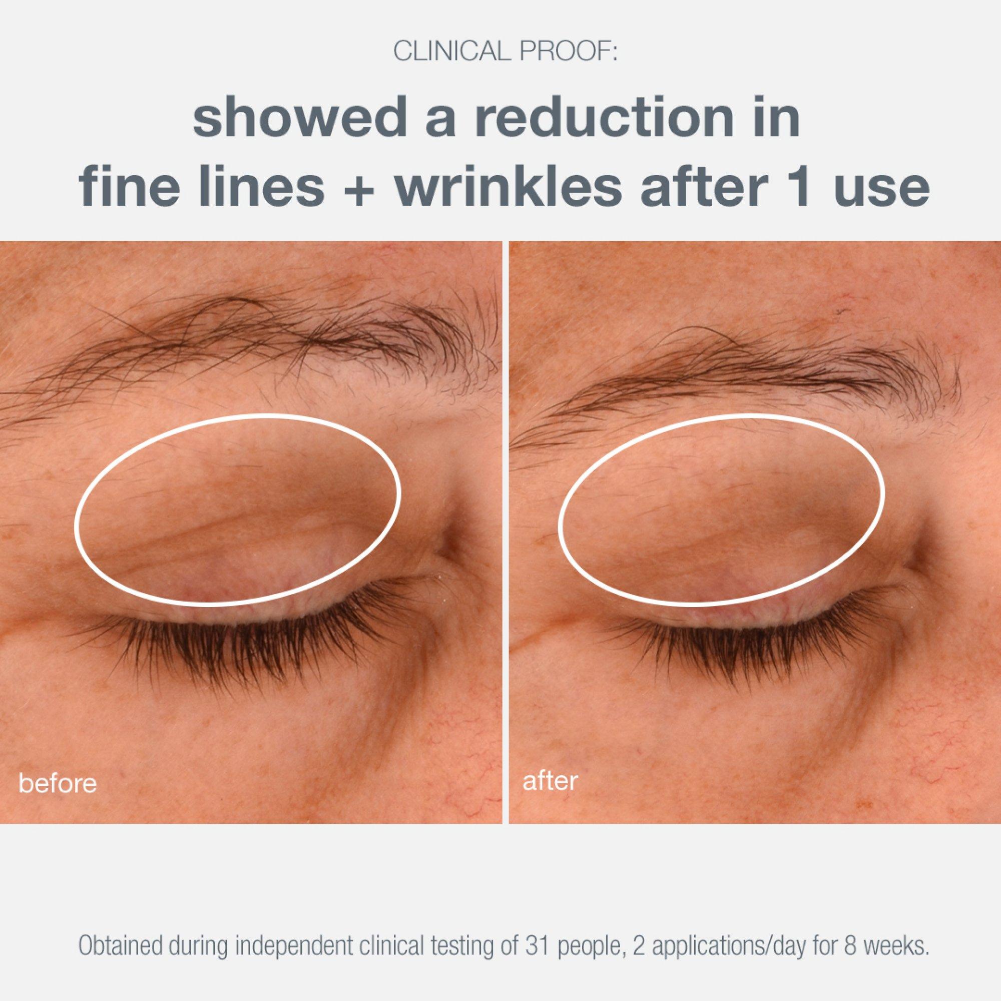 Clear - Dermalogica - Phyto Nature Lifting Eye Cream - 7