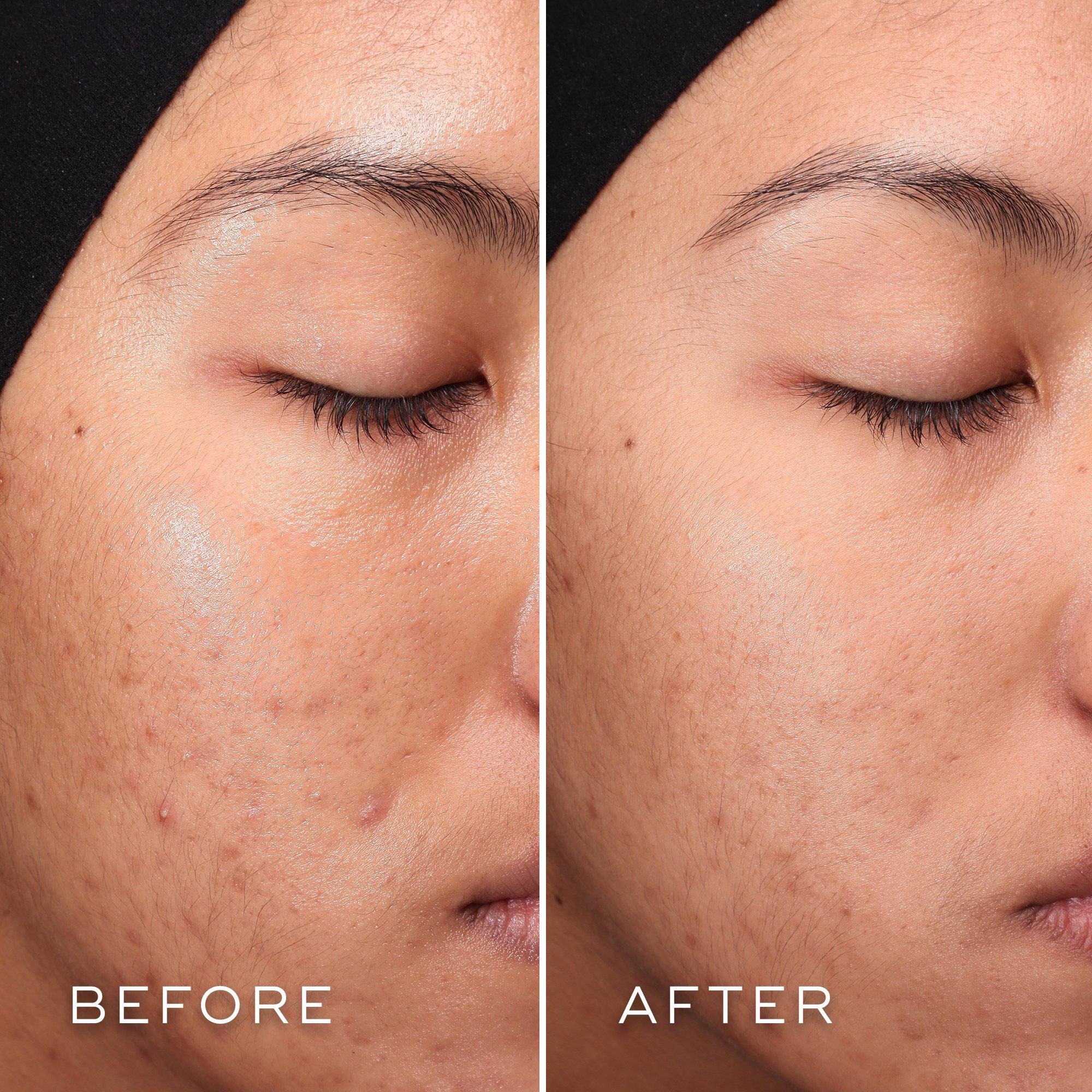 Clear - Medik8 - Medik8 PressC Refil Ld09 - 7