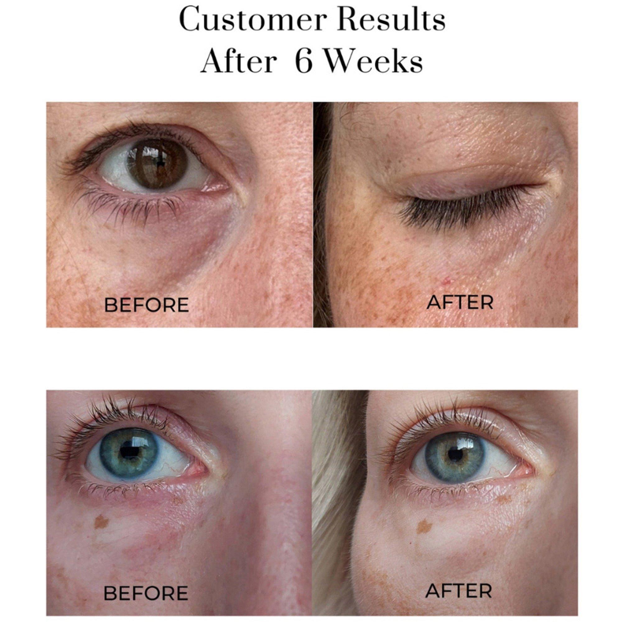 Serum - Oskia - Eye Wonder - 3