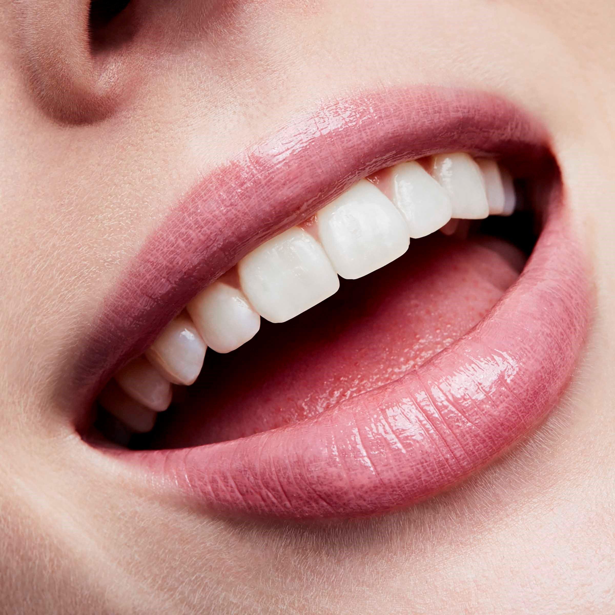 Candy Box - Mac - Lipglass - 3