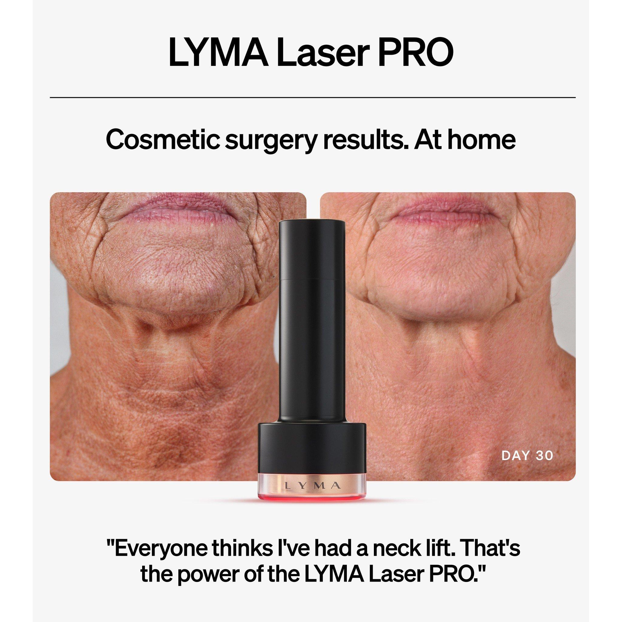 Not Applicable - LYMA - LASER PRO STARTER KIT - 3