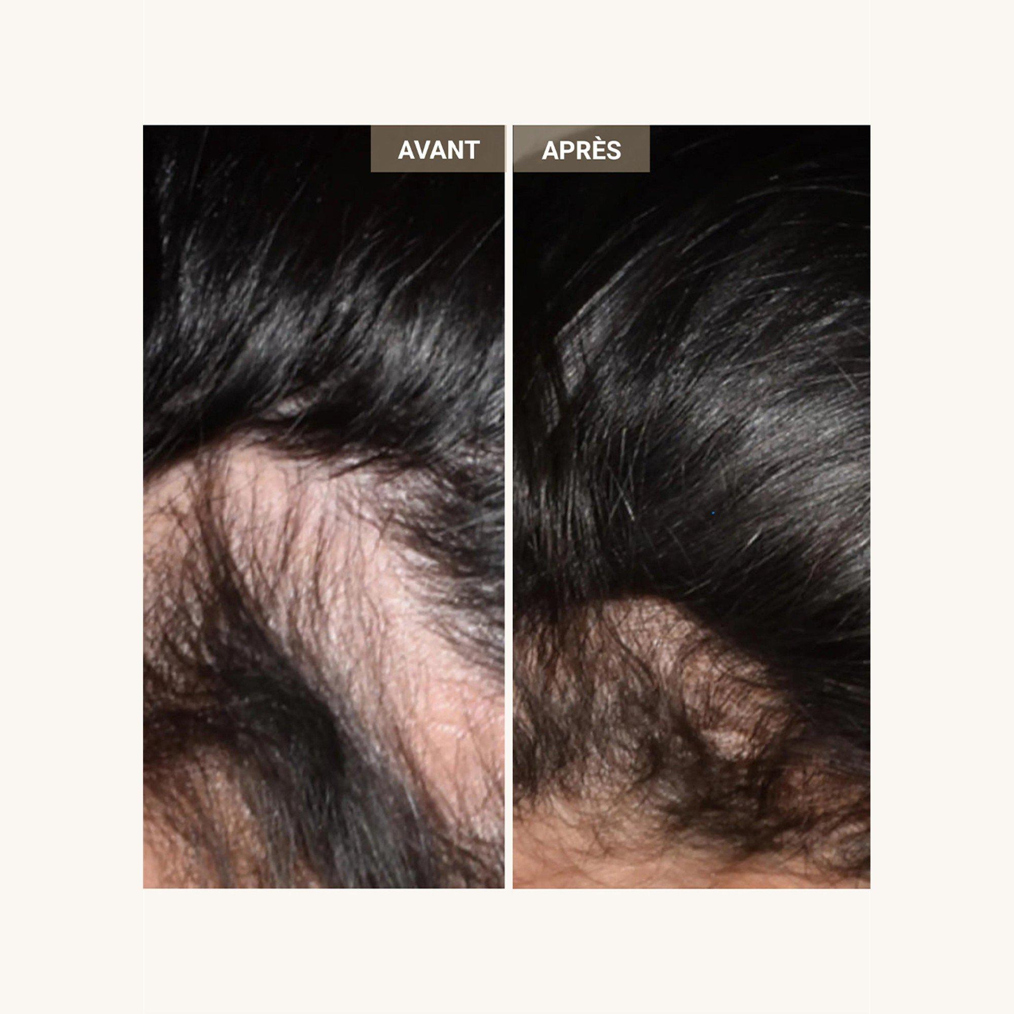 Not Applicable - Nooance - VG26 Growth Hair Helmet - 6