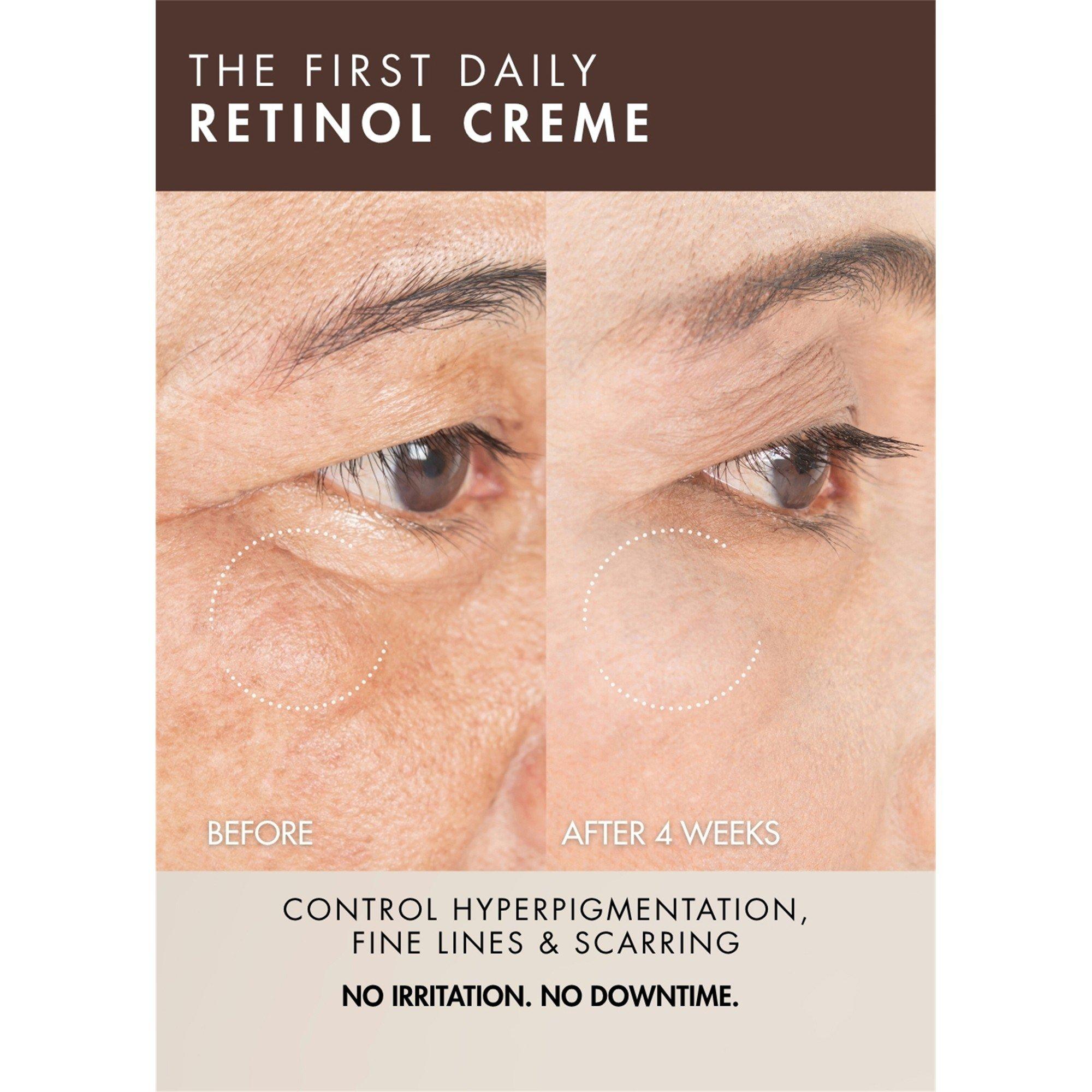 Not Applicable - Skin Design London - RETINOL GEL CREME 50ML - 3