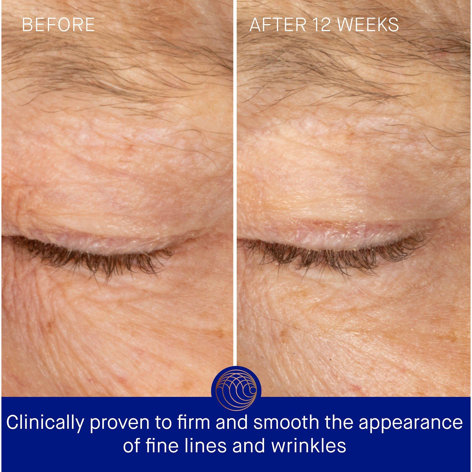 Not Applicable - Augustinus Bader - THE RICH EYE CREAM - 3