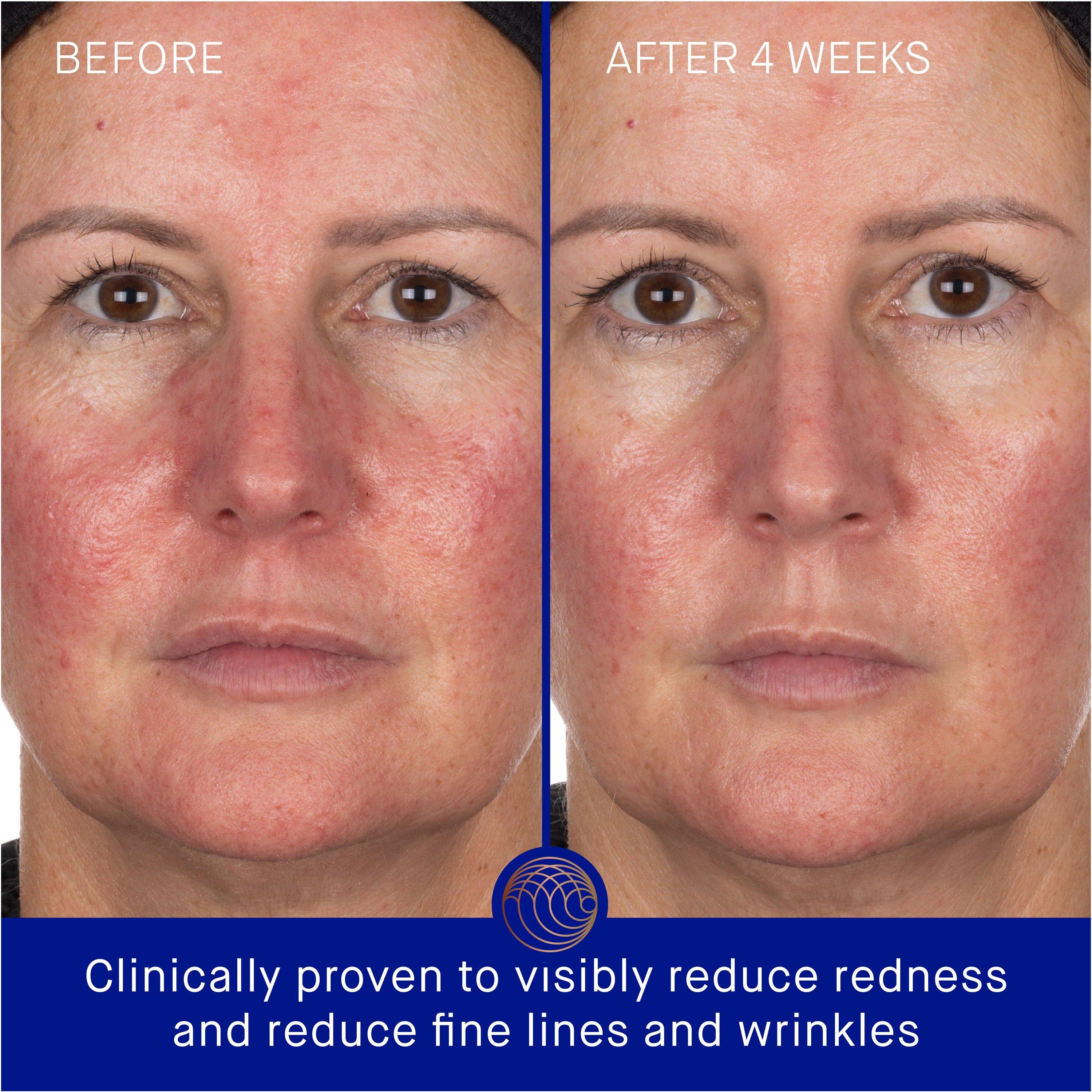 Not Applicable - Augustinus Bader - THE HYDROGEL FACE MASK X - 3