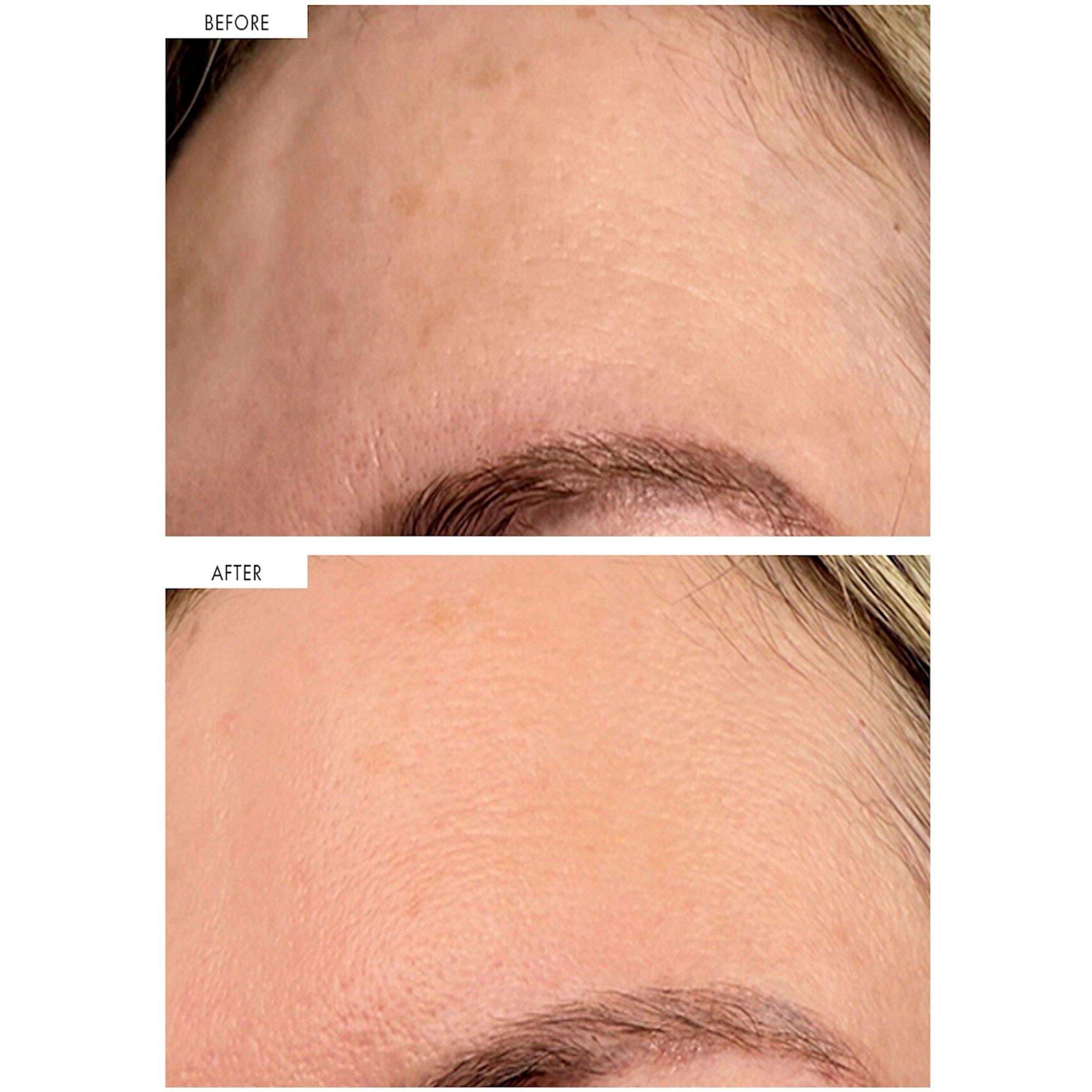 Not Applicable - 111SKIN - DARK SPOT CORRECTING SERU - 6