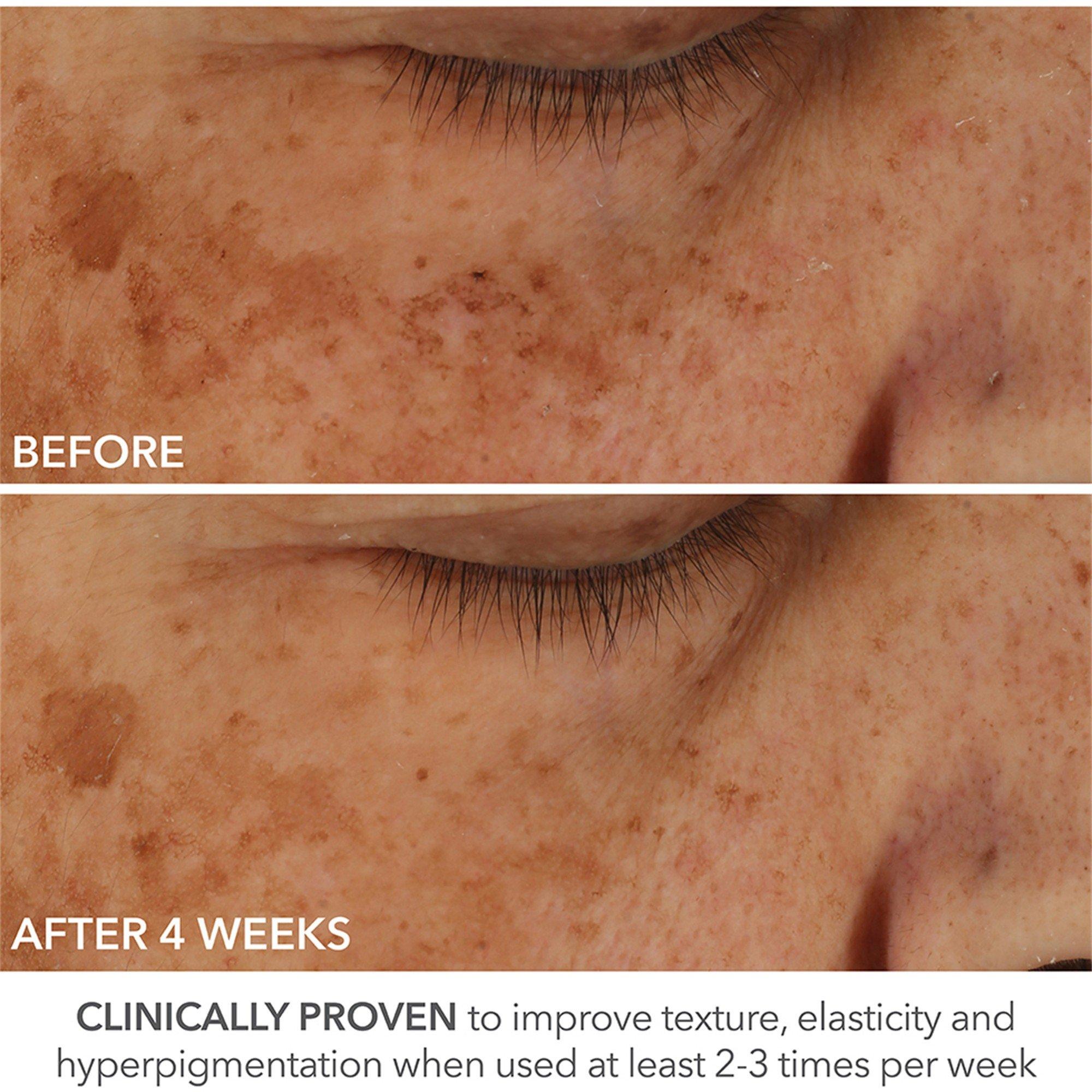 Not Applicable - Dr Dennis Gross Skincare - ADVANCED RETINOL + FERULI - 4