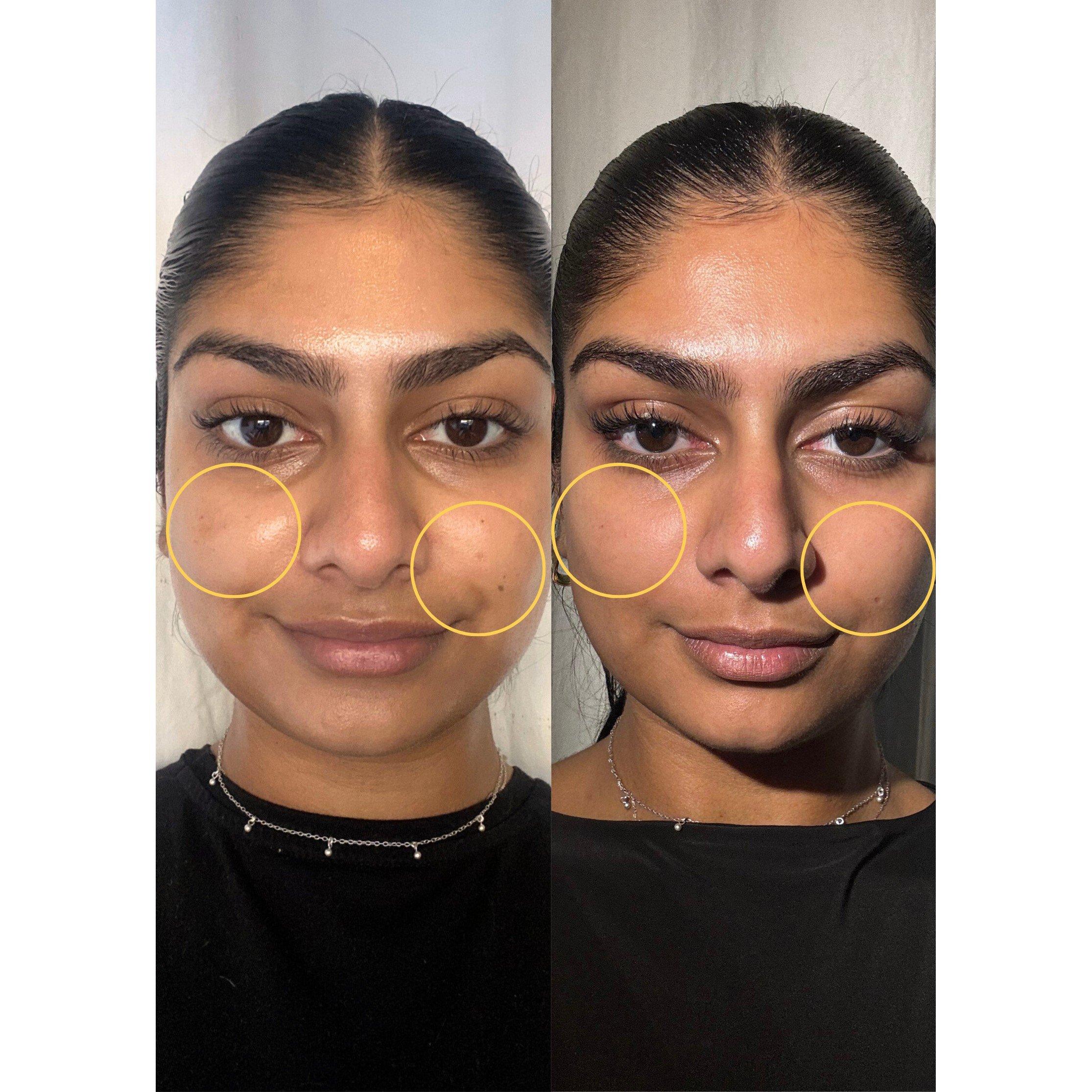Not Applicable - Dr David Jack - YELLOW PEEL - 6