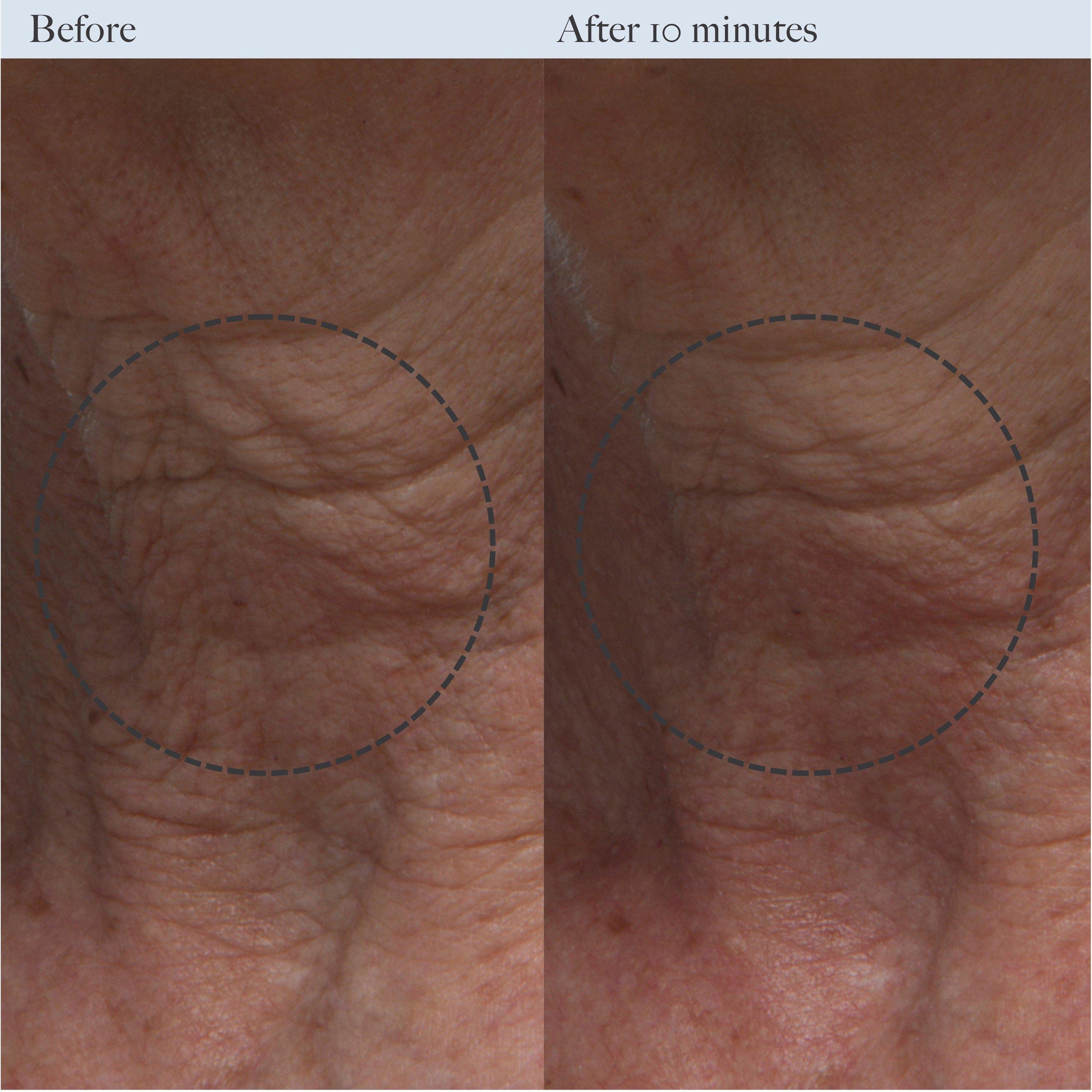 Not Applicable - Dr Loretta - RESURFACING ENZYME POLISH - 4