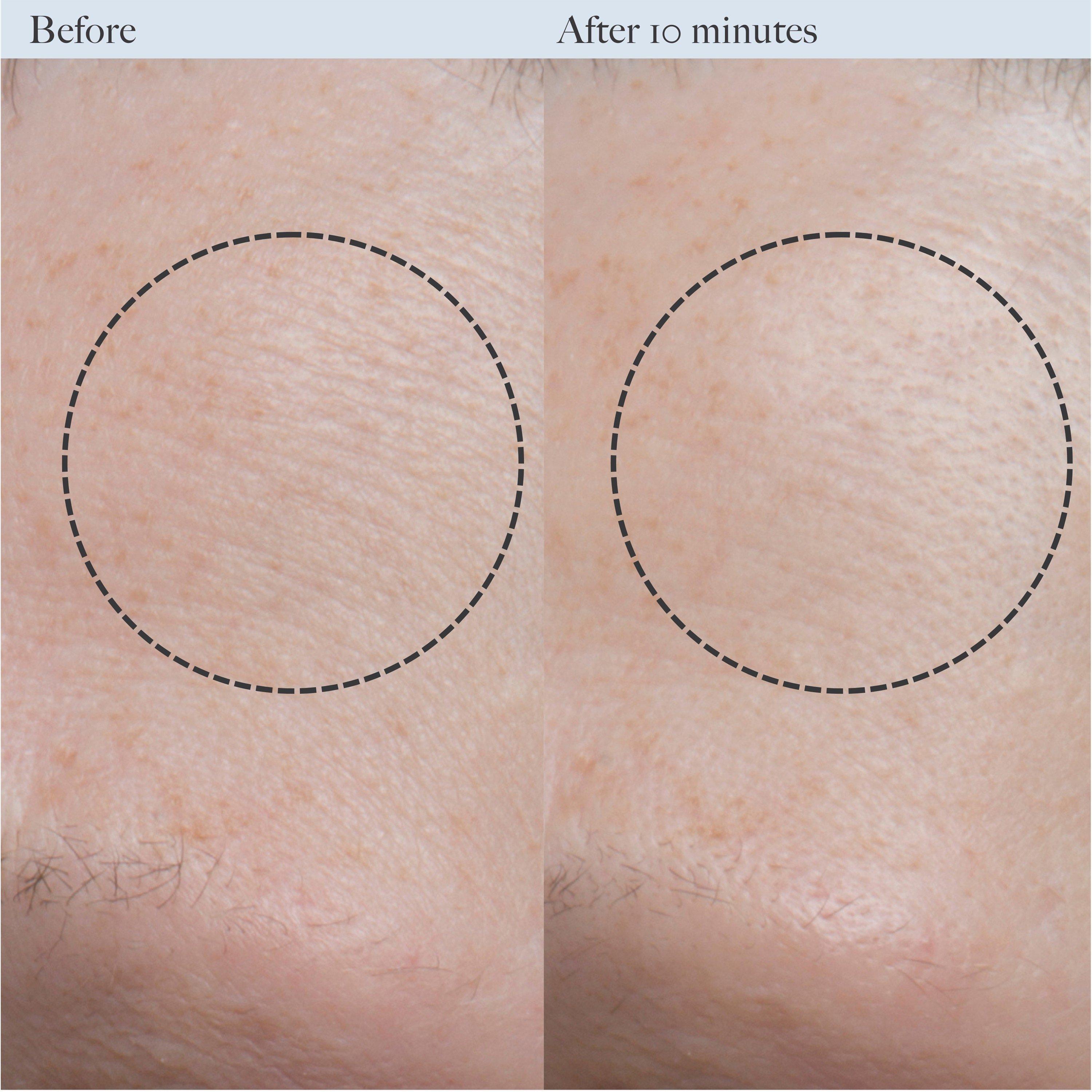 Not Applicable - Dr Loretta - RESURFACING ENZYME POLISH - 5