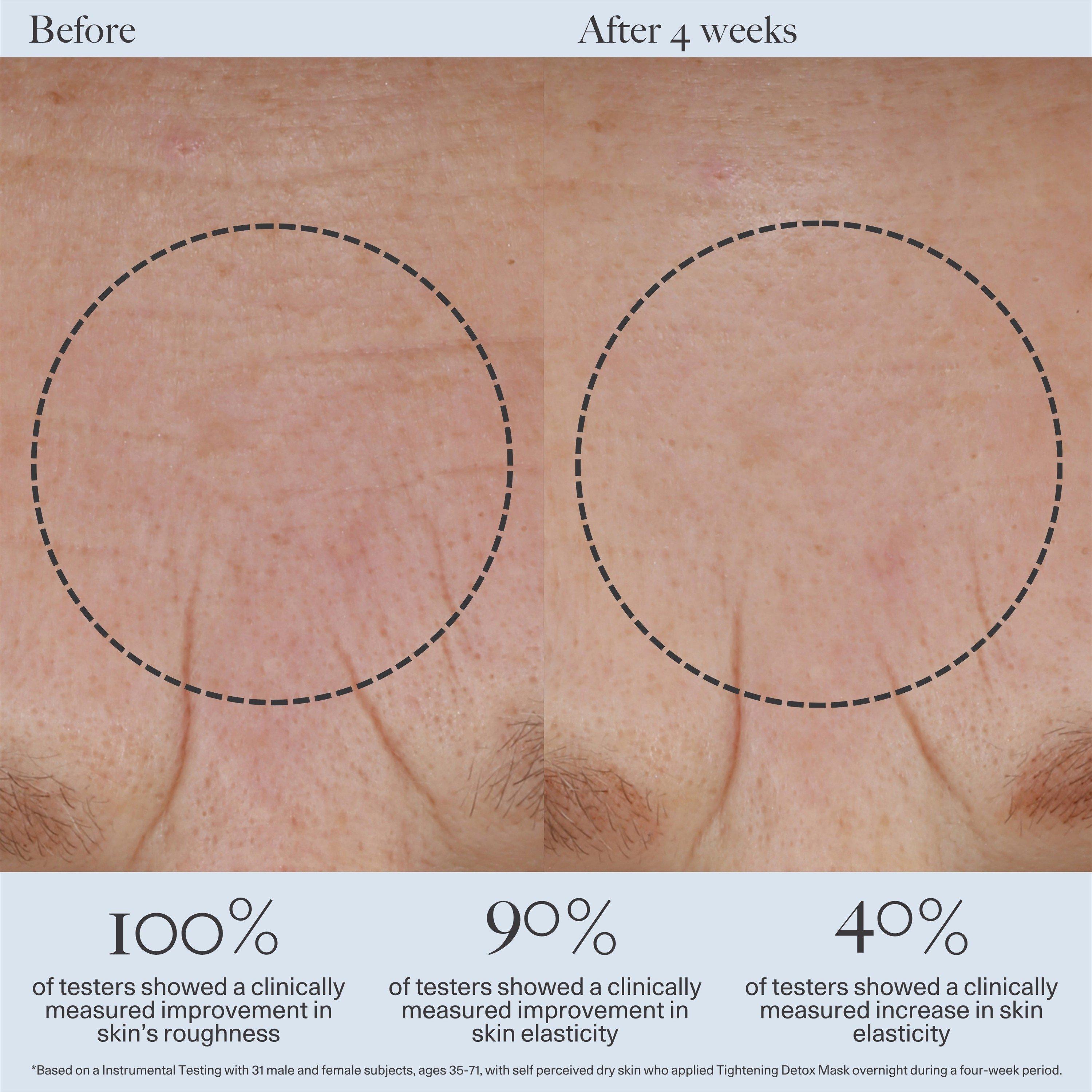 Not Applicable - Dr Loretta - TIGHTENING DETOX MASK - 4