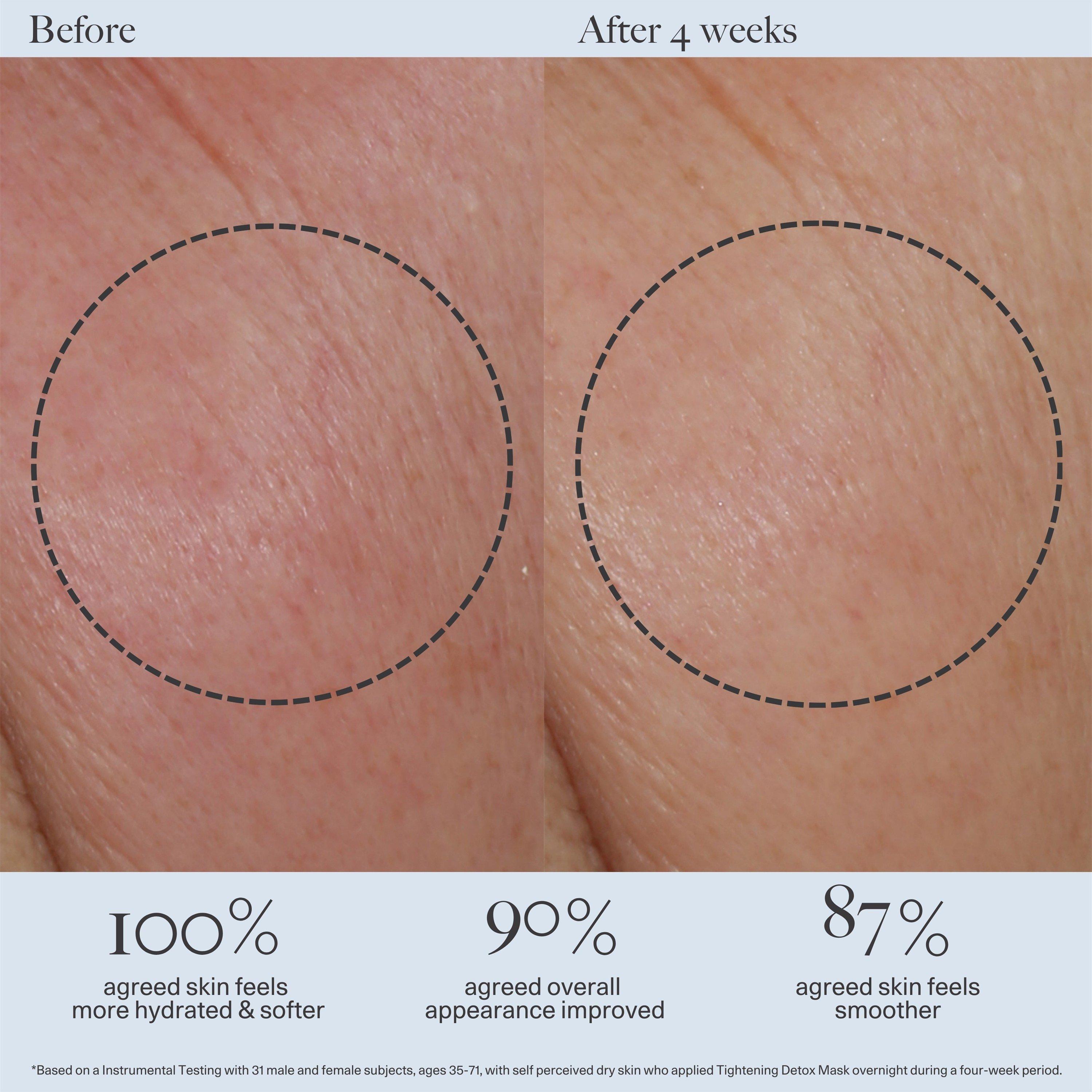 Not Applicable - Dr Loretta - TIGHTENING DETOX MASK - 5