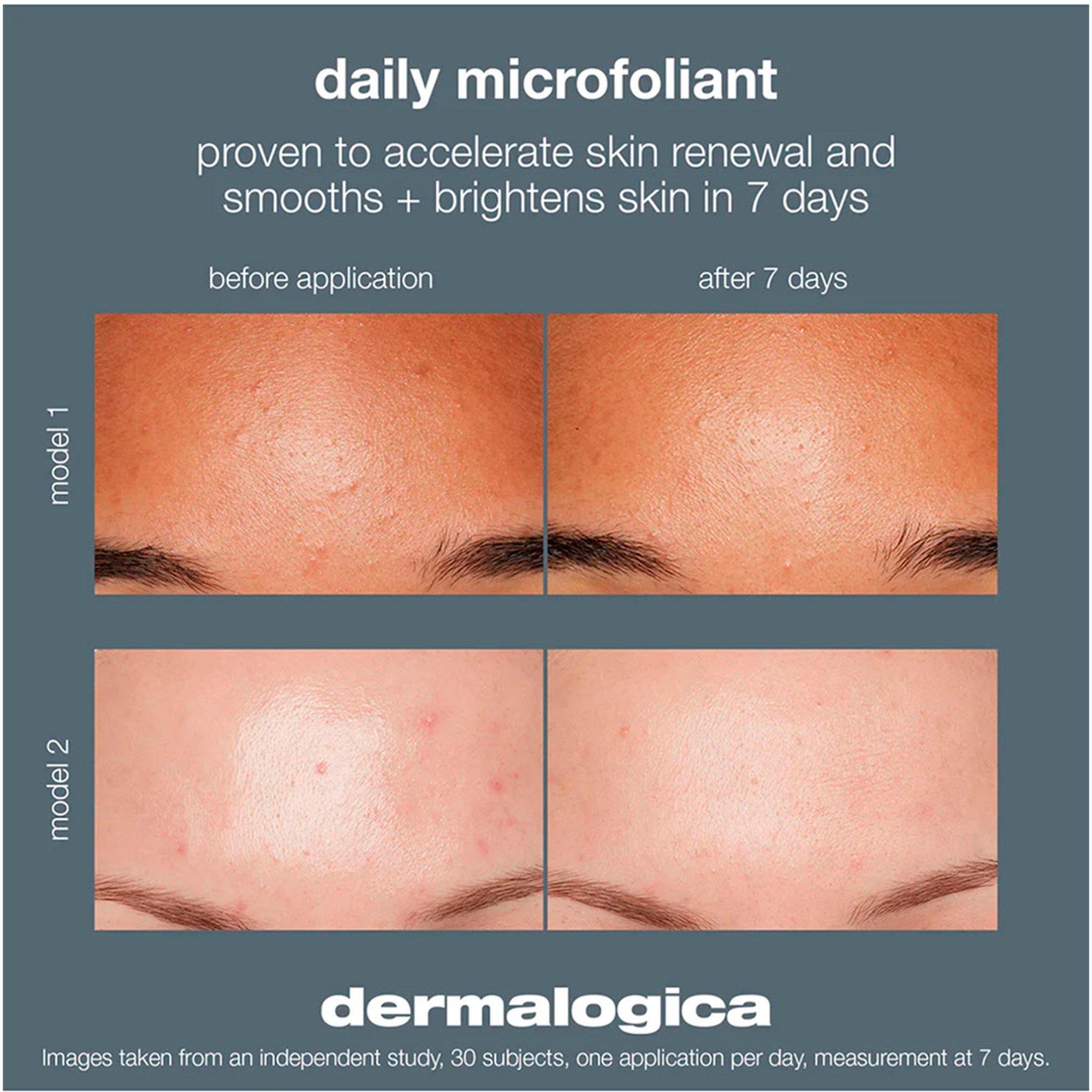 Not Applicable - Dermalogica - DAILY MICROFOLIANT 13GM - 5