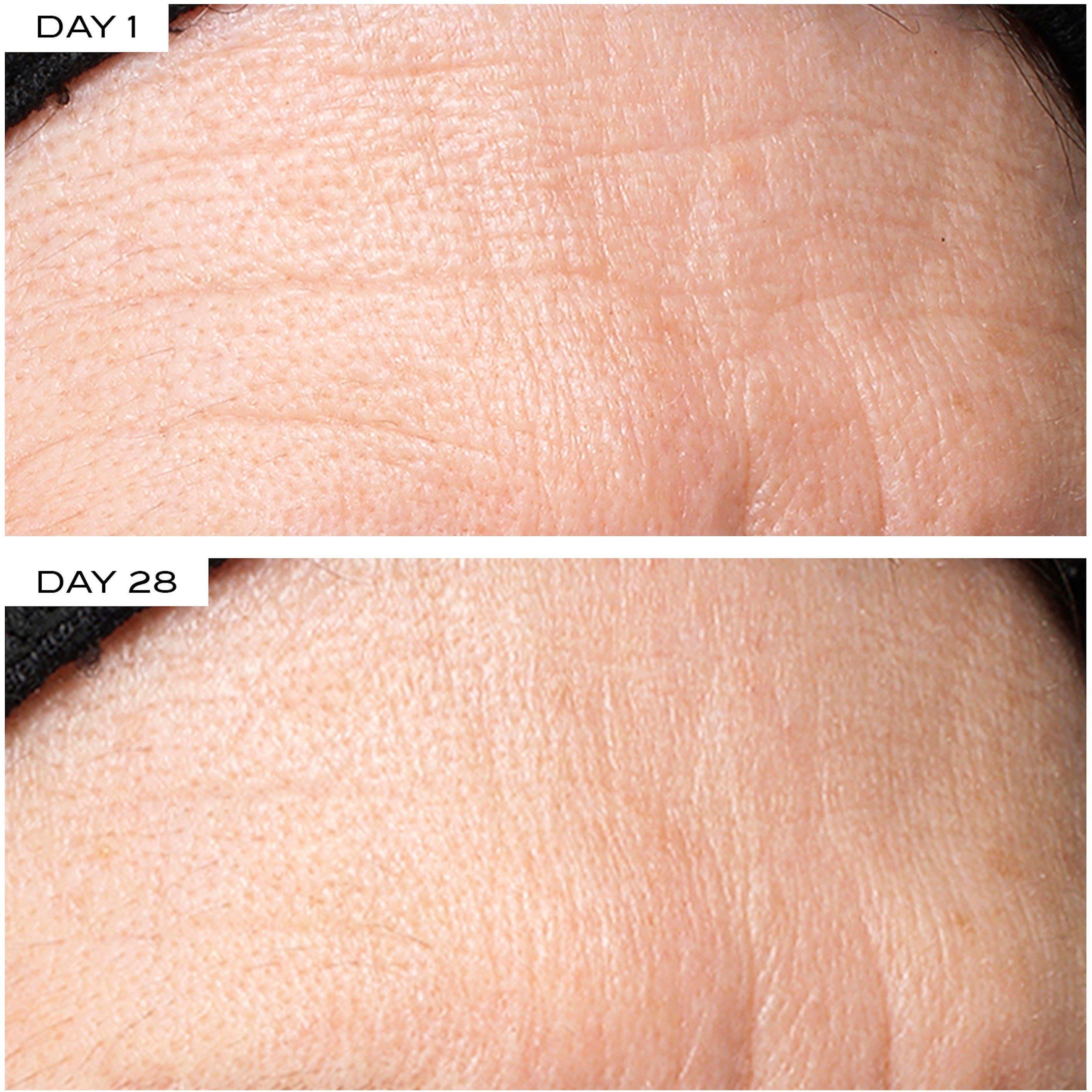 Not Applicable - 111SKIN - Exosome Face Lift - 5