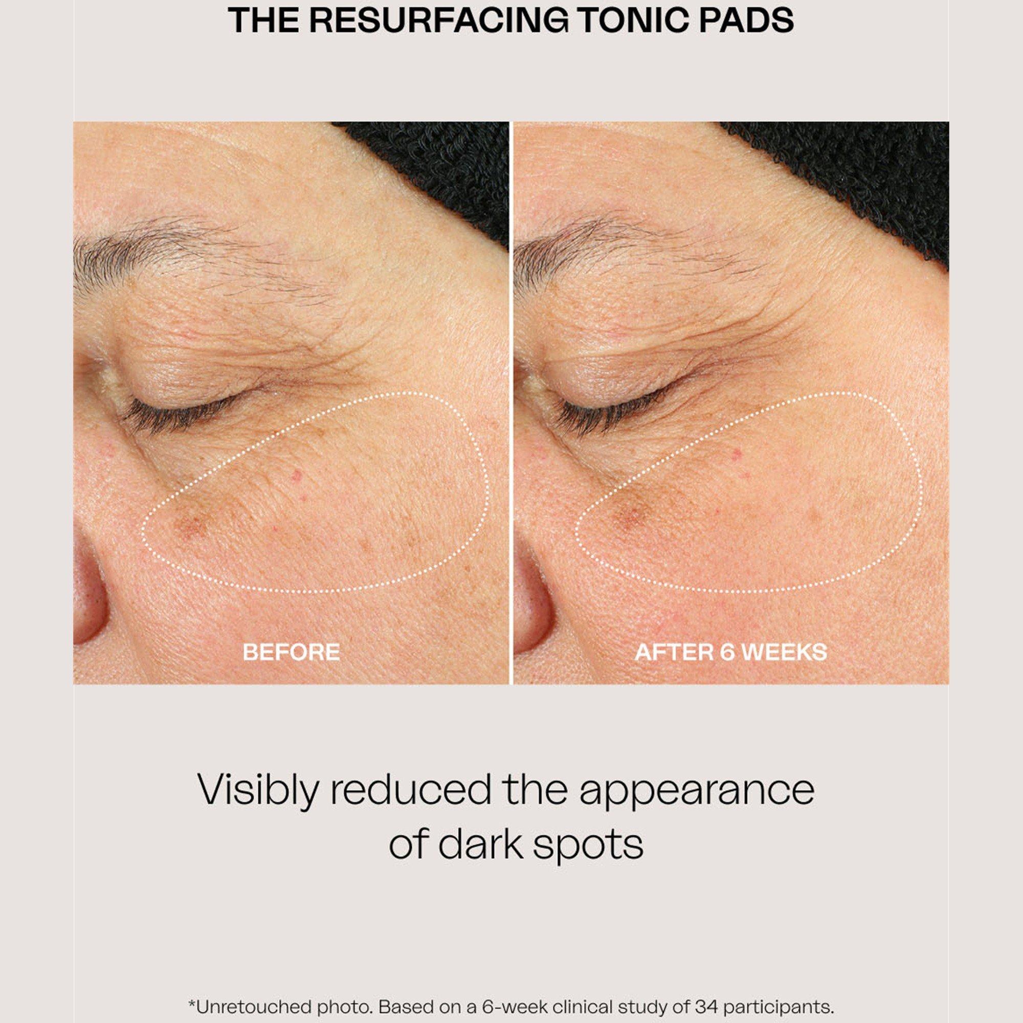 Not Applicable - Eighth Day - VG26 The Resurfacing Toni - 5
