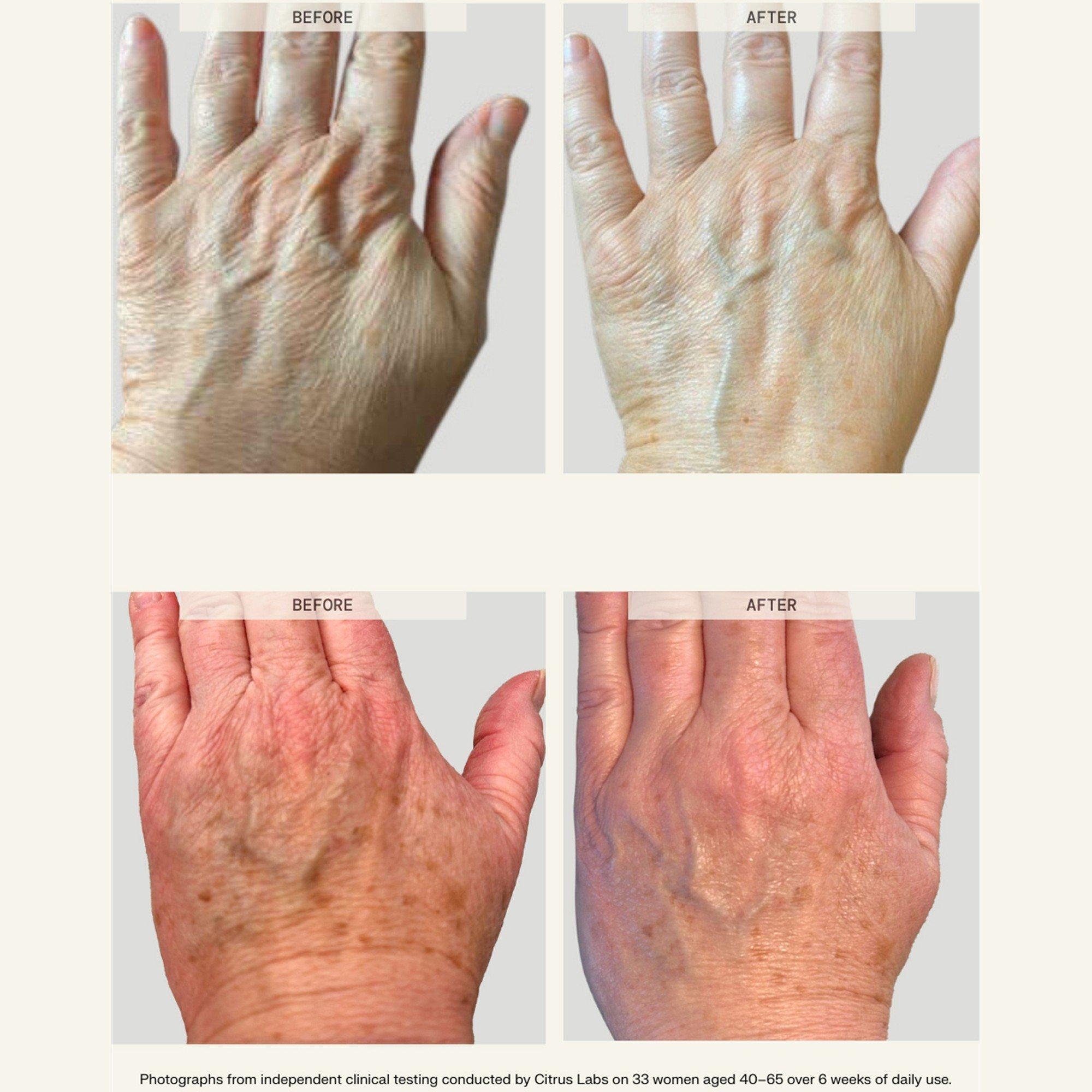 Not Applicable - Habelo - VG26 Activating Hand Seru - 5