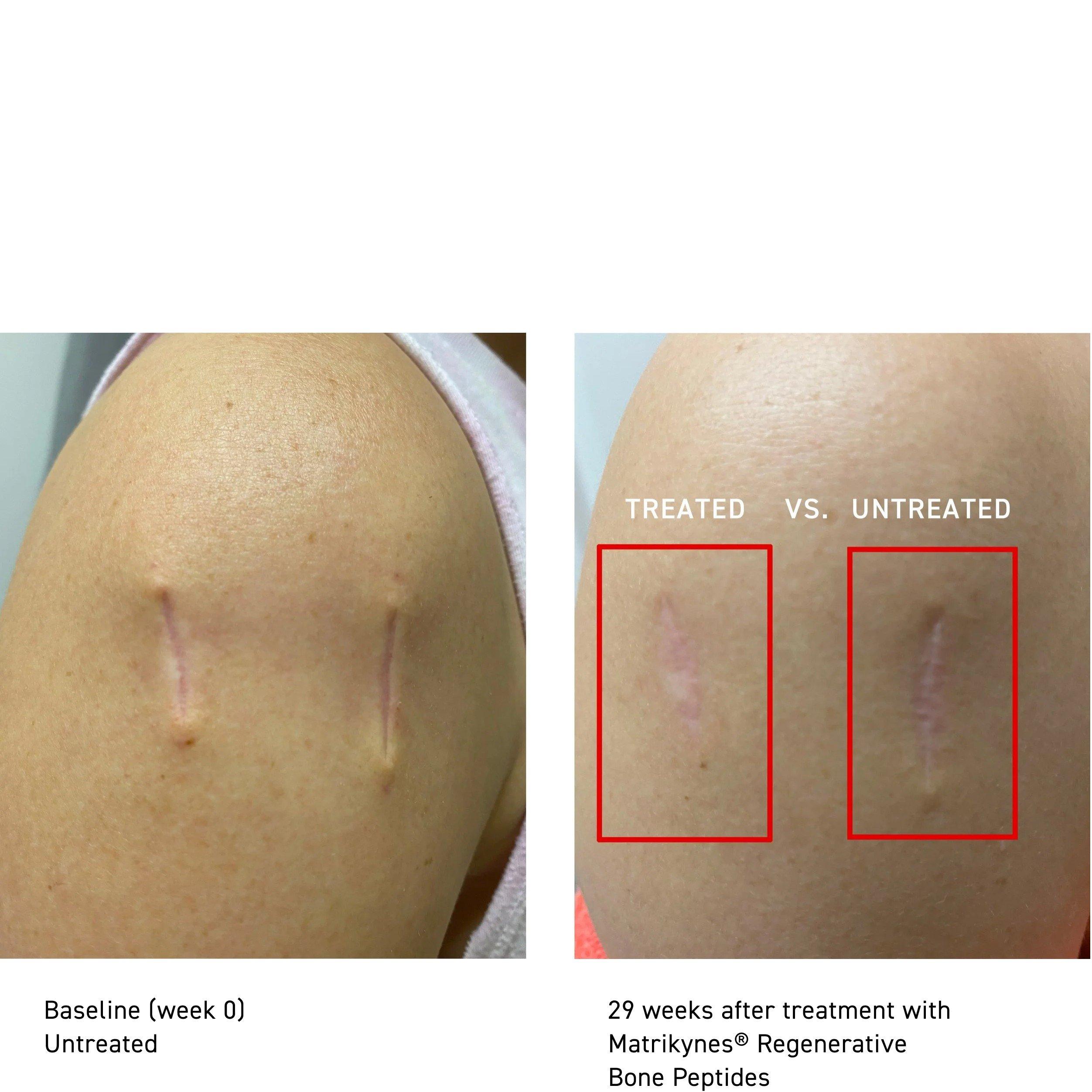 Not Applicable - Sweet Chemistry - VG26 Barrier Repairing Hy - 8