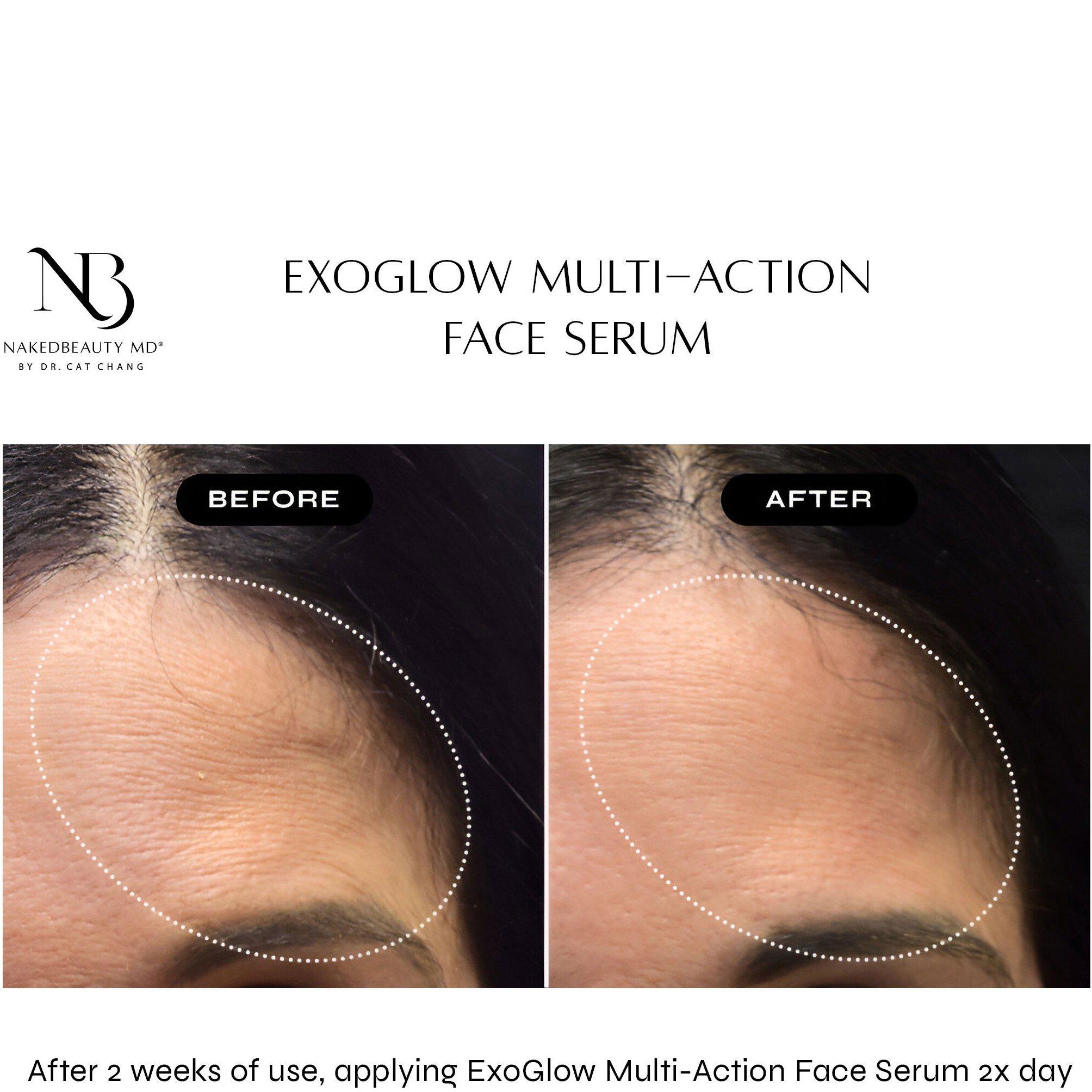Not Applicable - Naked Beauty - VG26 Exoglow Face Serum - 4