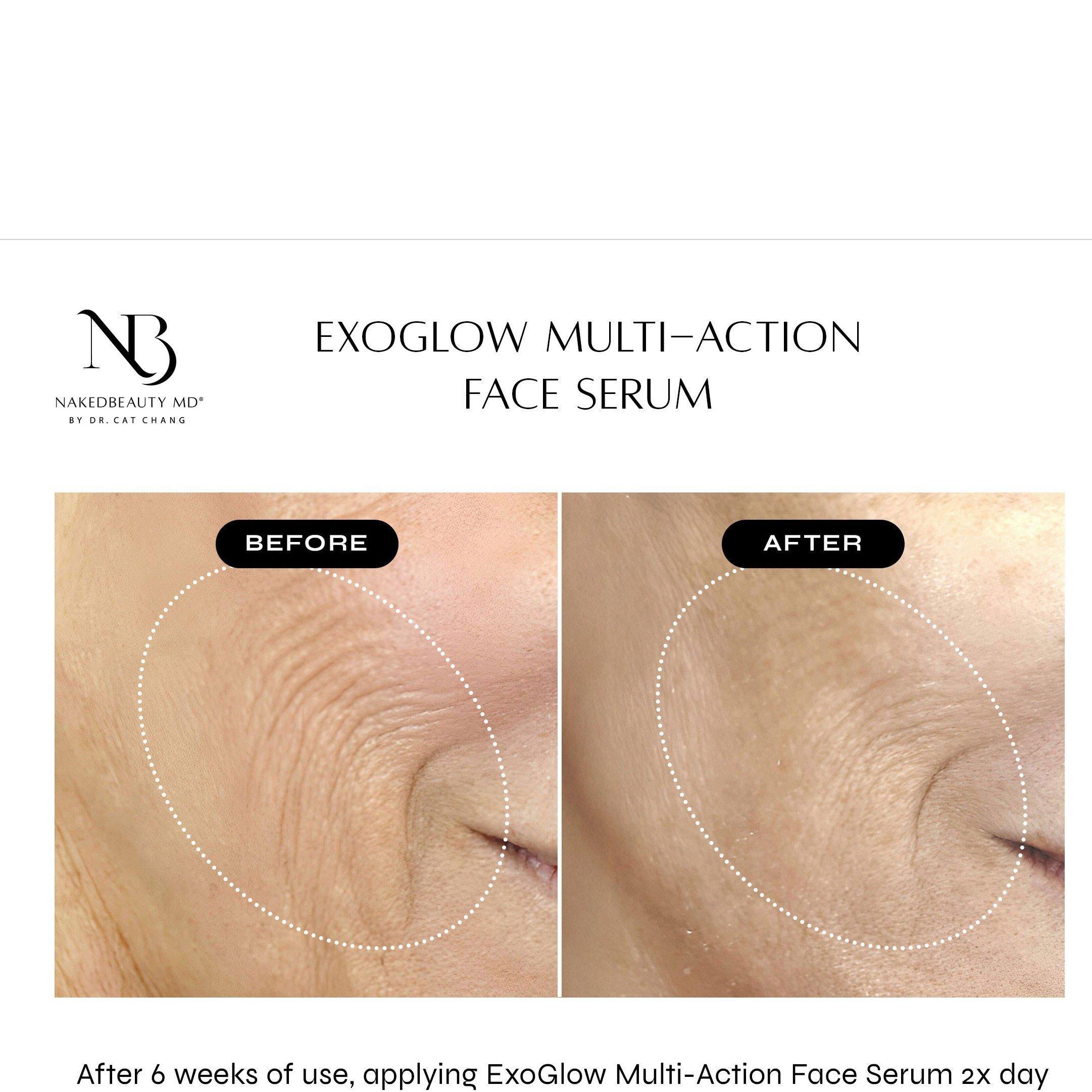 Not Applicable - Naked Beauty - VG26 Exoglow Face Serum - 5