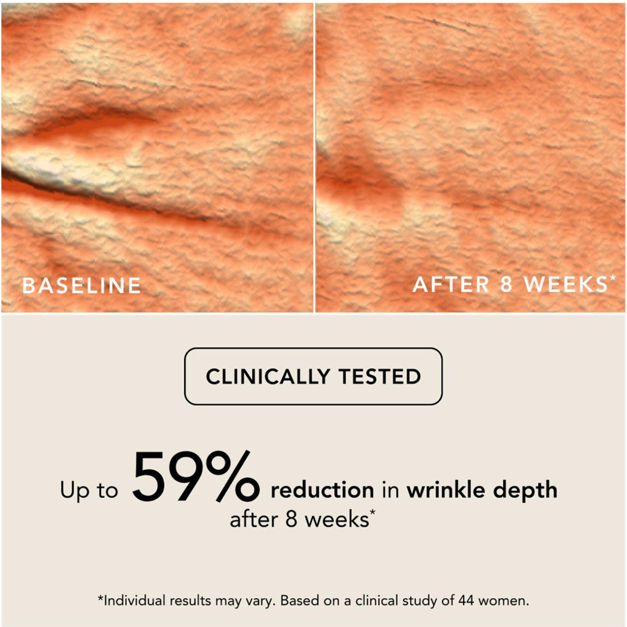NUDE 12 - Chantecaille - Women's Bio Lifting Concealer - 4