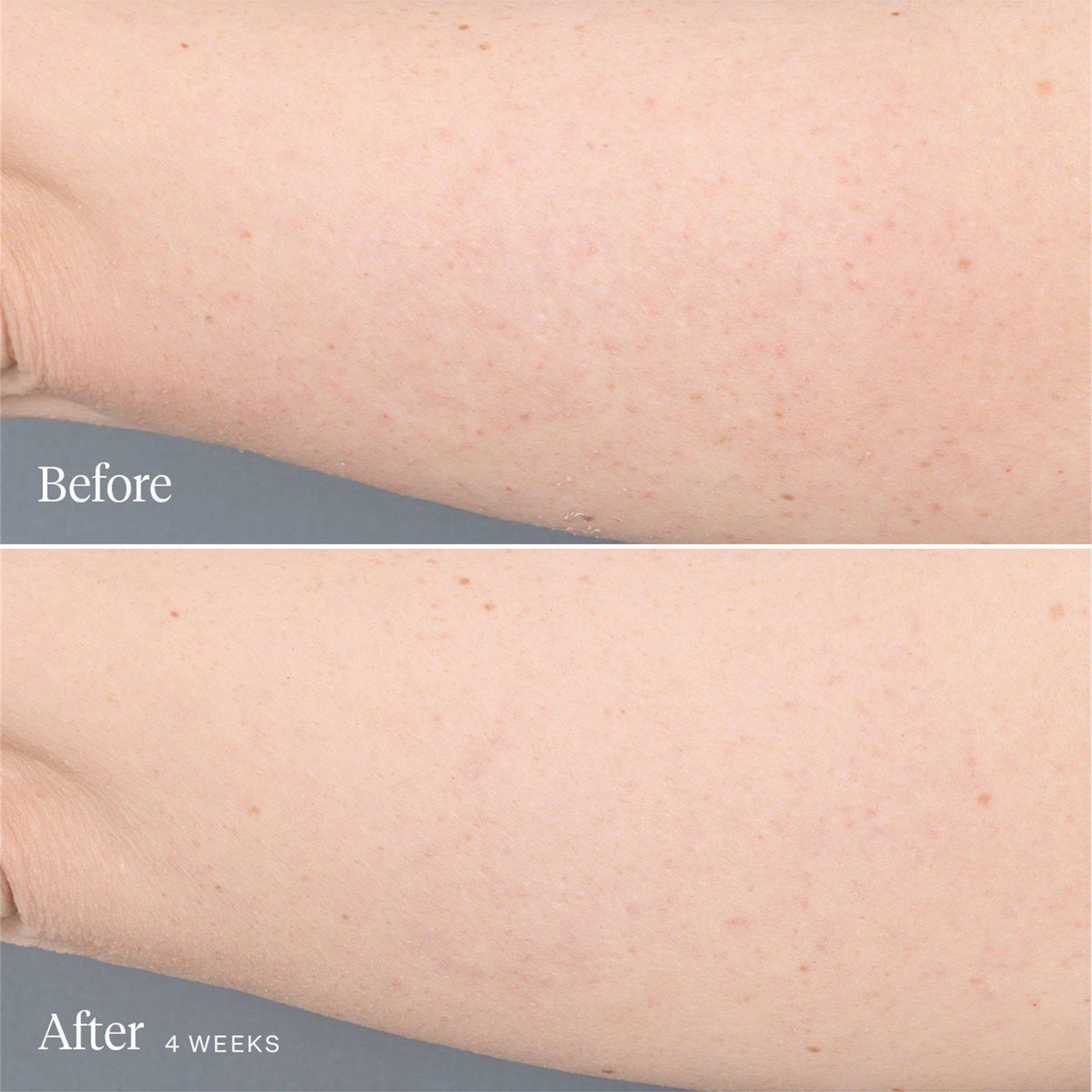 Not Applicable - JOONBYRD - KALEIDOSCOPE BODY SERUM - 4