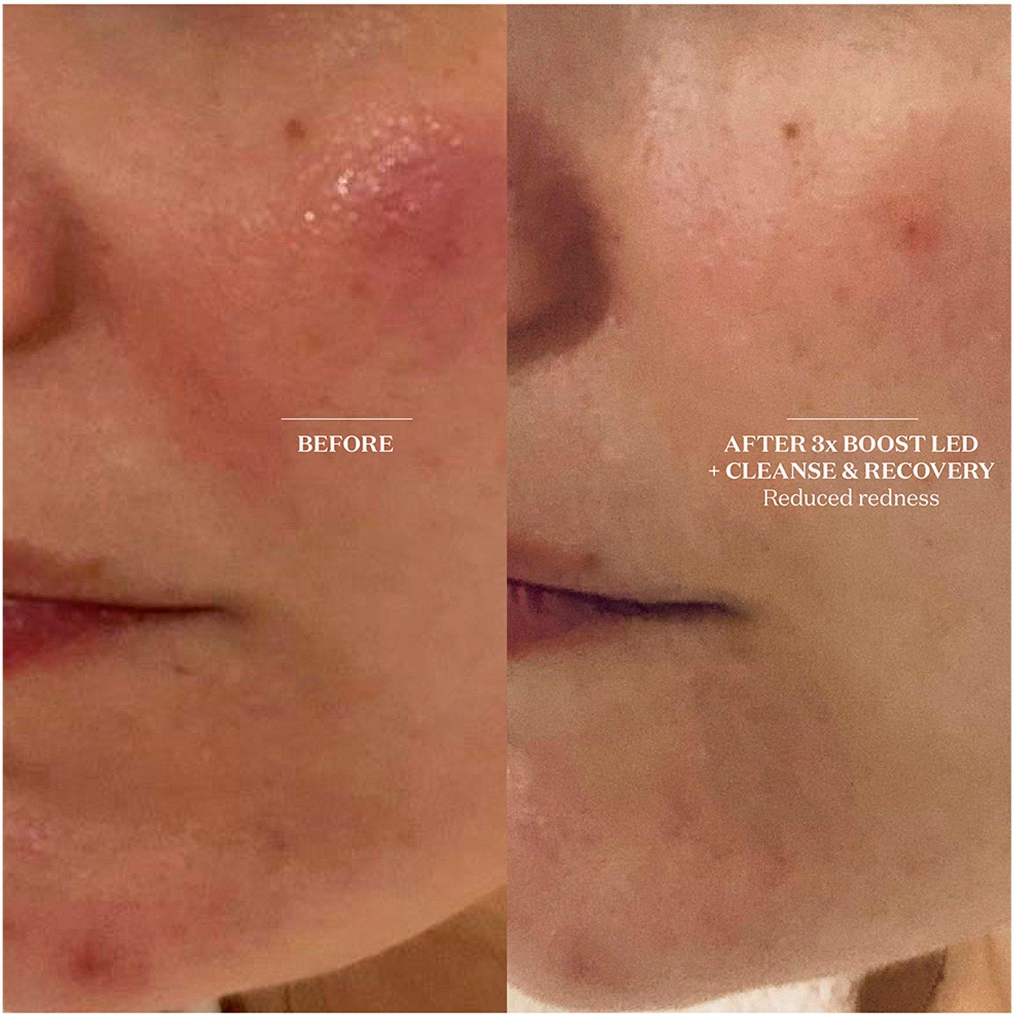 Not Applicable - Unknown - CLEANSE & RECOVERY SPRAY - 3