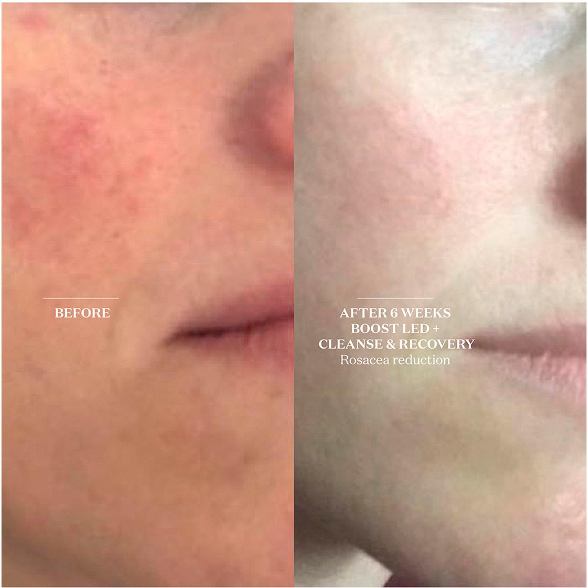 Not Applicable - Unknown - CLEANSE & RECOVERY SPRAY - 5