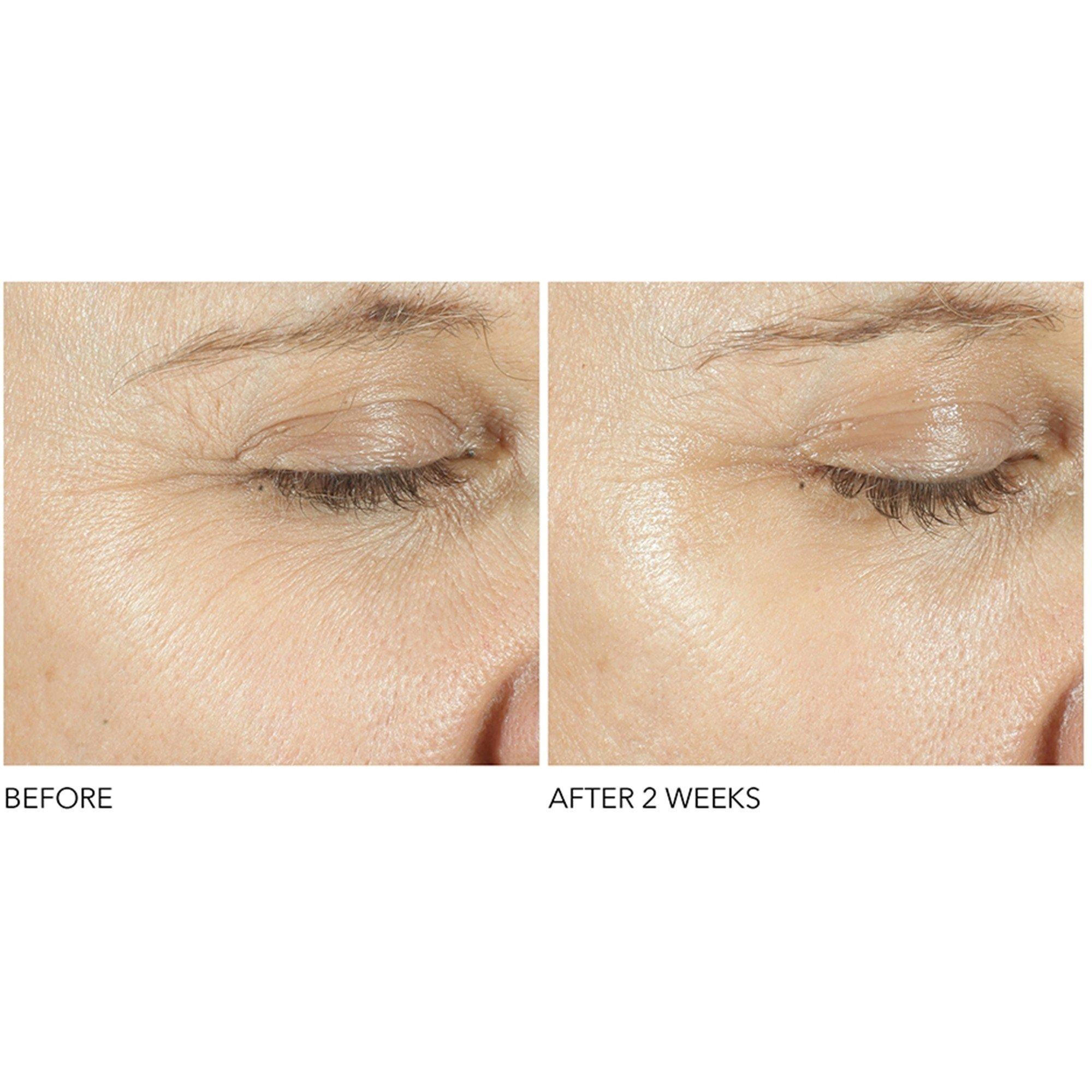 Not Applicable - Dr Dennis Gross Skincare - ADVN RETINOL FERULIC EYE - 3