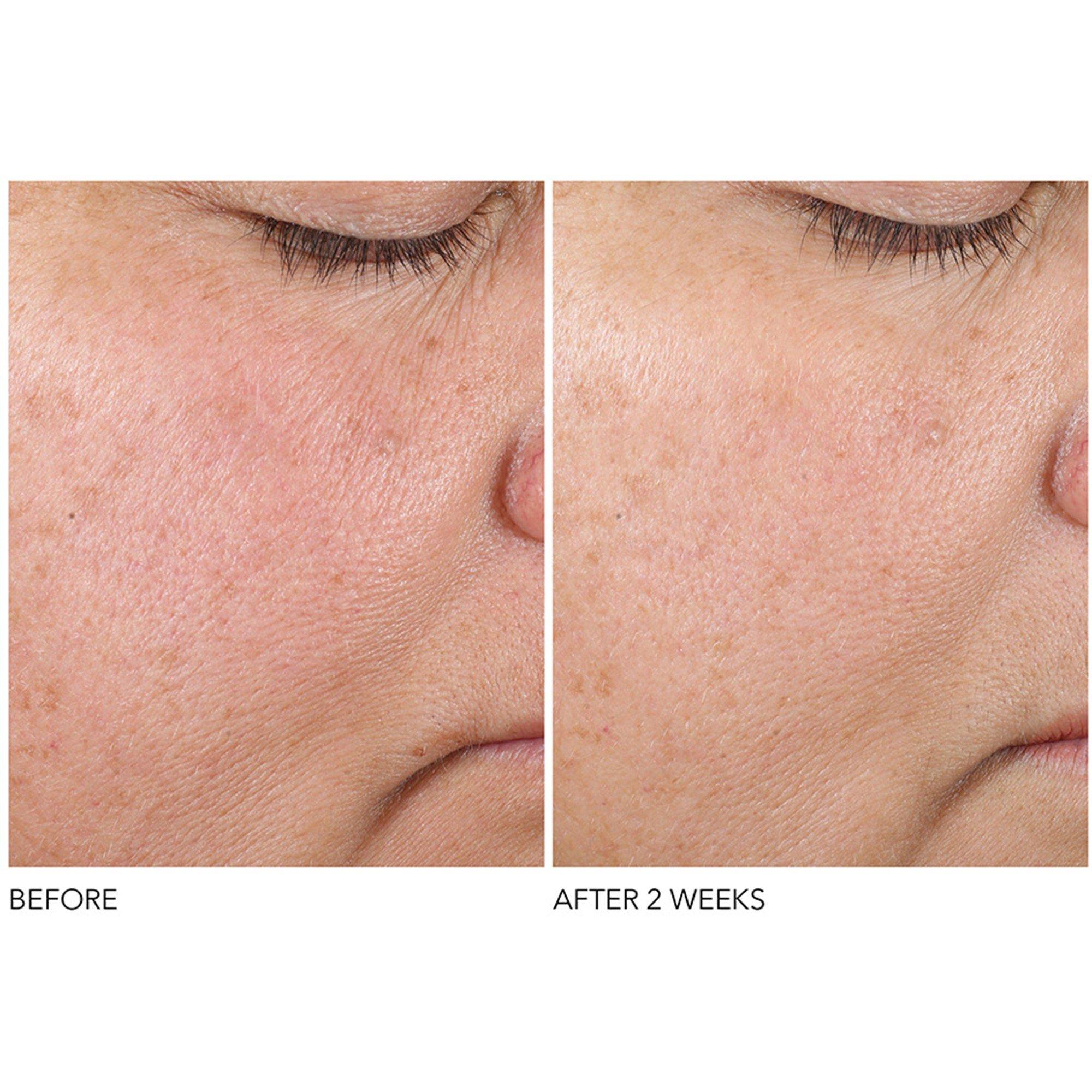 Not Applicable - Dr Dennis Gross Skincare - ADVNCD RETINOL FERULIC SE - 3