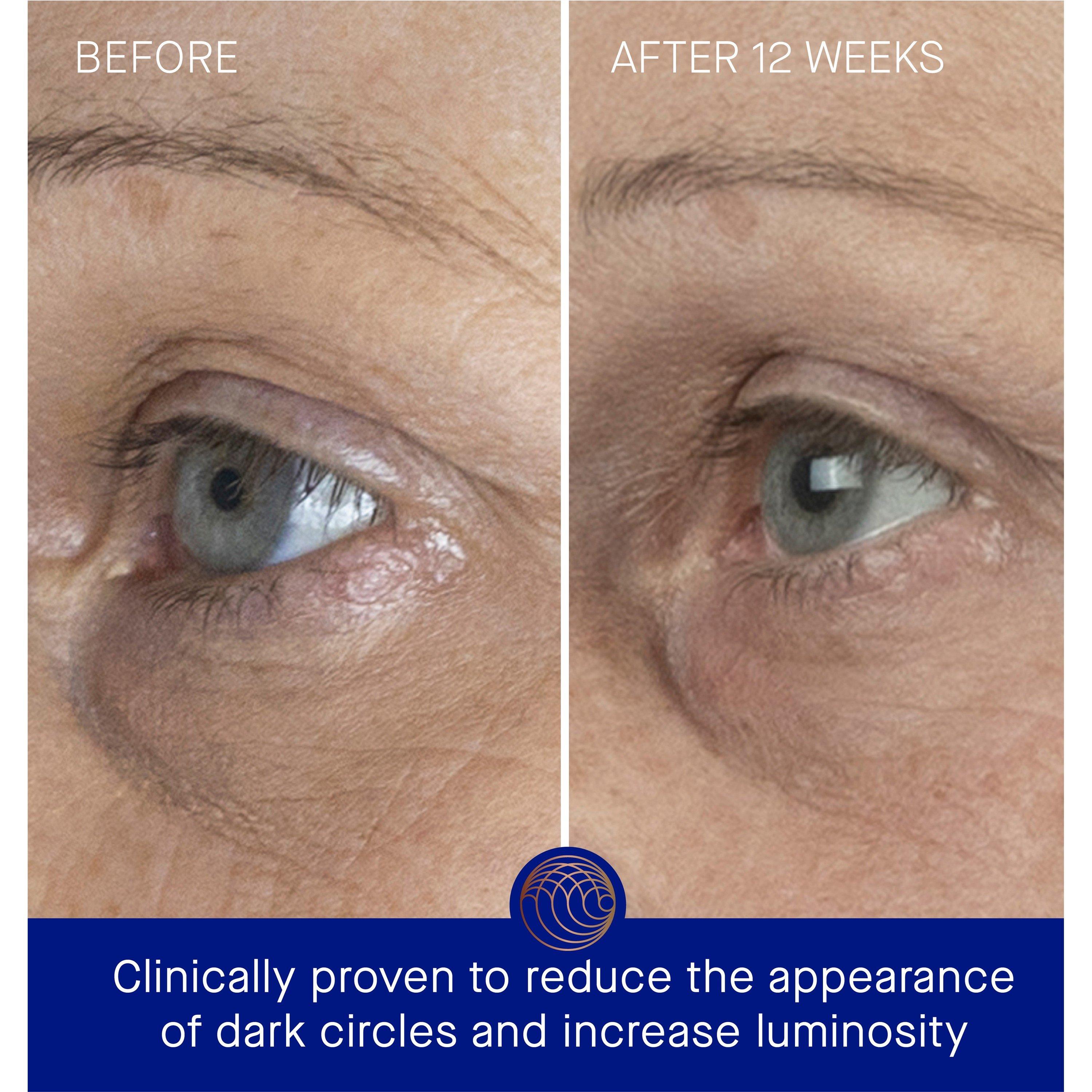 Not Applicable - Augustinus Bader - THE EYE CREAM 15ML - 4