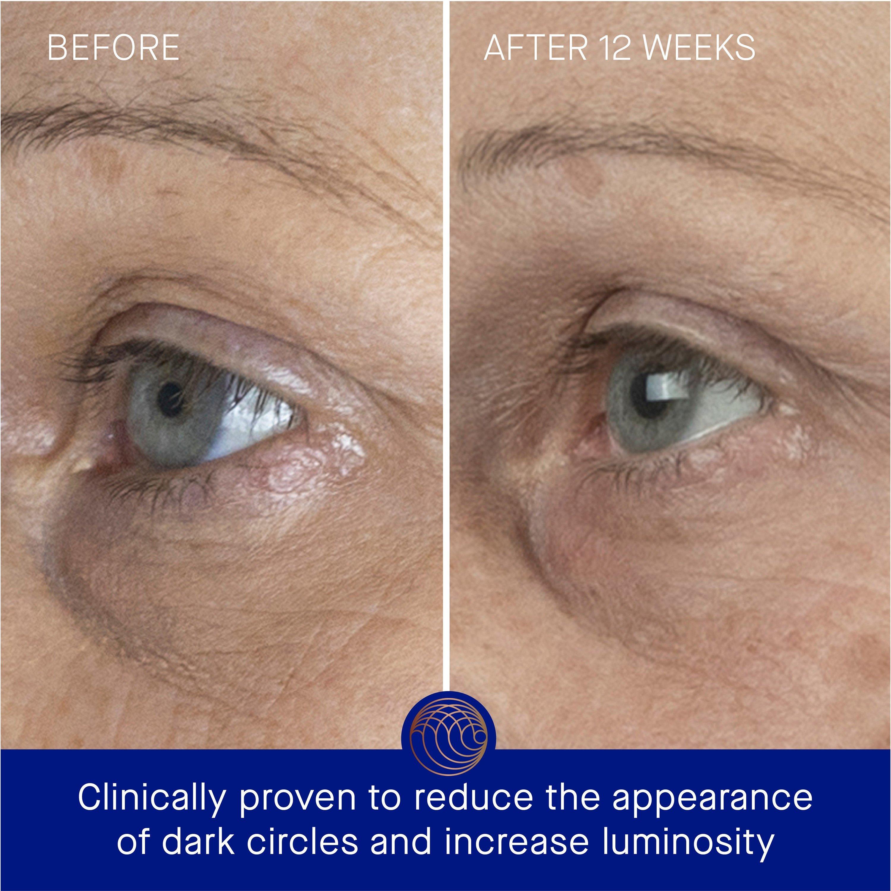 Not Applicable - Augustinus Bader - THE EYE CREAM NOMAD - 4