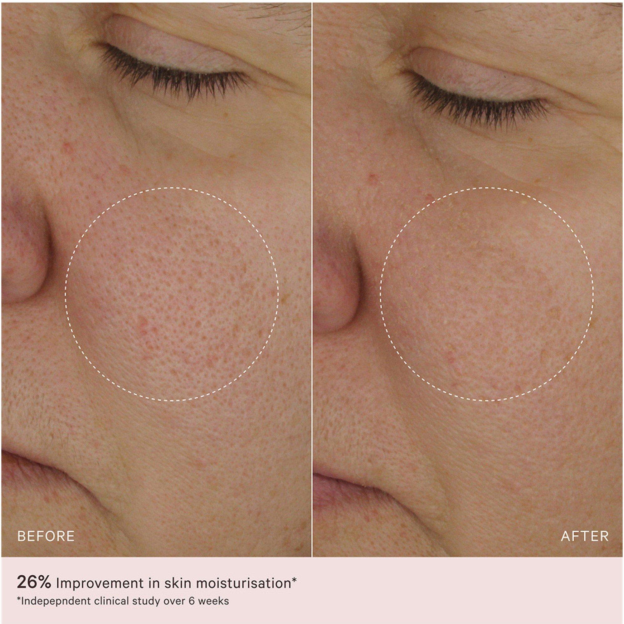 Not Applicable - MZ Skin - LIGHT MOISTURISER - 6